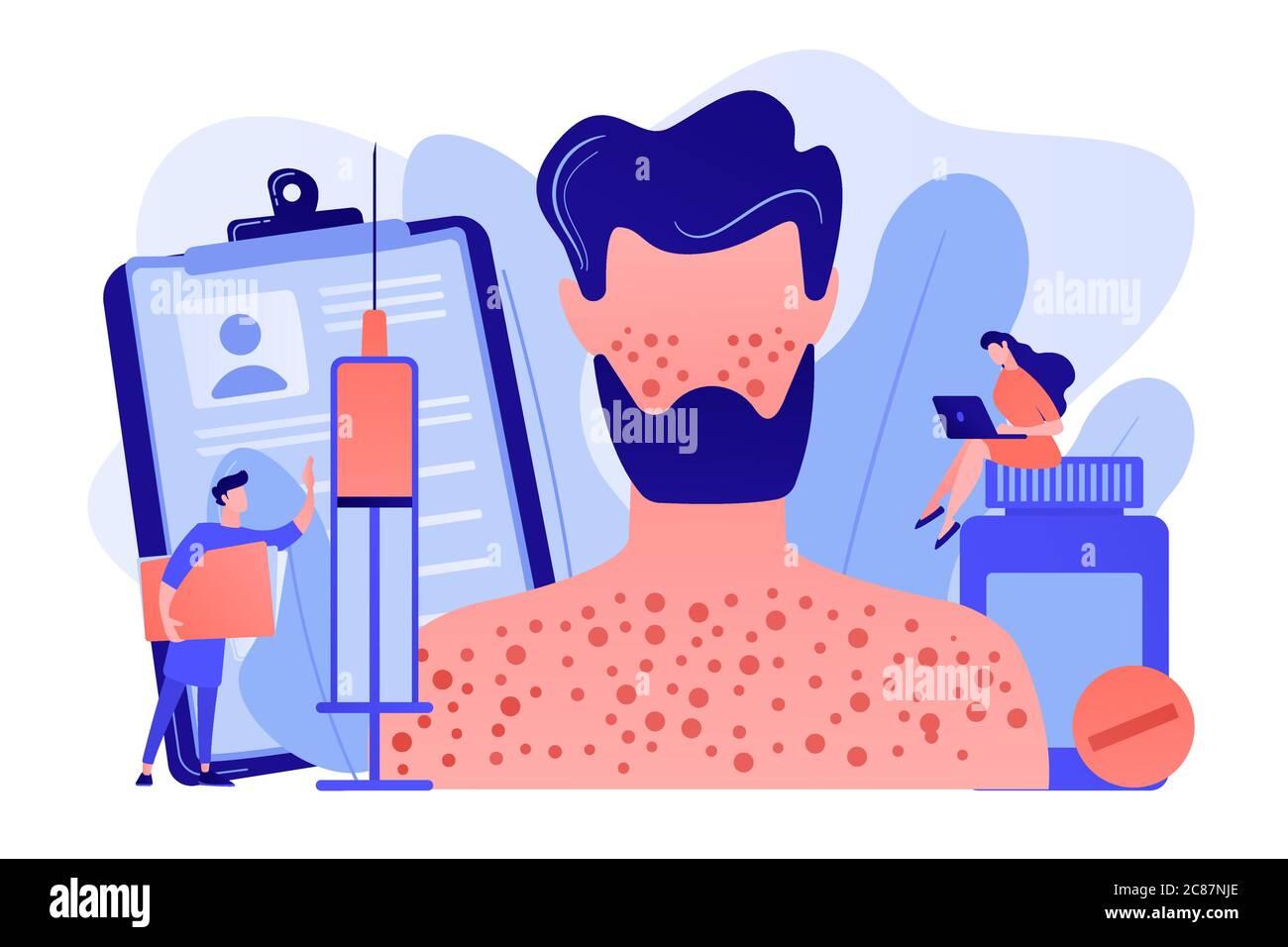 Abbildung des Konzepts „Arzneimittelallergie“. Stock Vektor