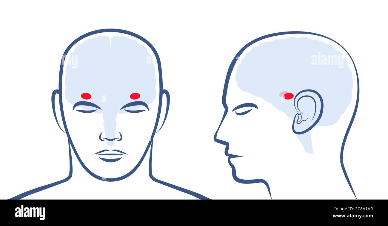 AMYGDALAE. Lage der beiden Amigdalas im menschlichen Gehirn. Profil und Frontalansicht mit Positionen - grafische Darstellung auf weißem Hintergrund. Stockfoto
