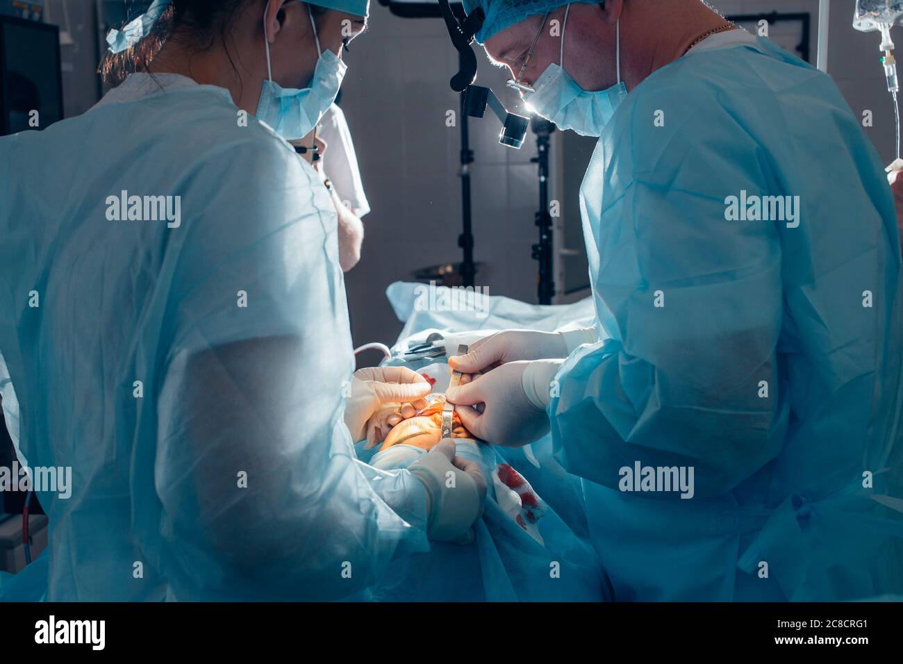 Medizinisches Team, das Operation auf der Nase durchführt. Gruppe des Chirurgen bei der Arbeit im Operationssaal Stockfoto