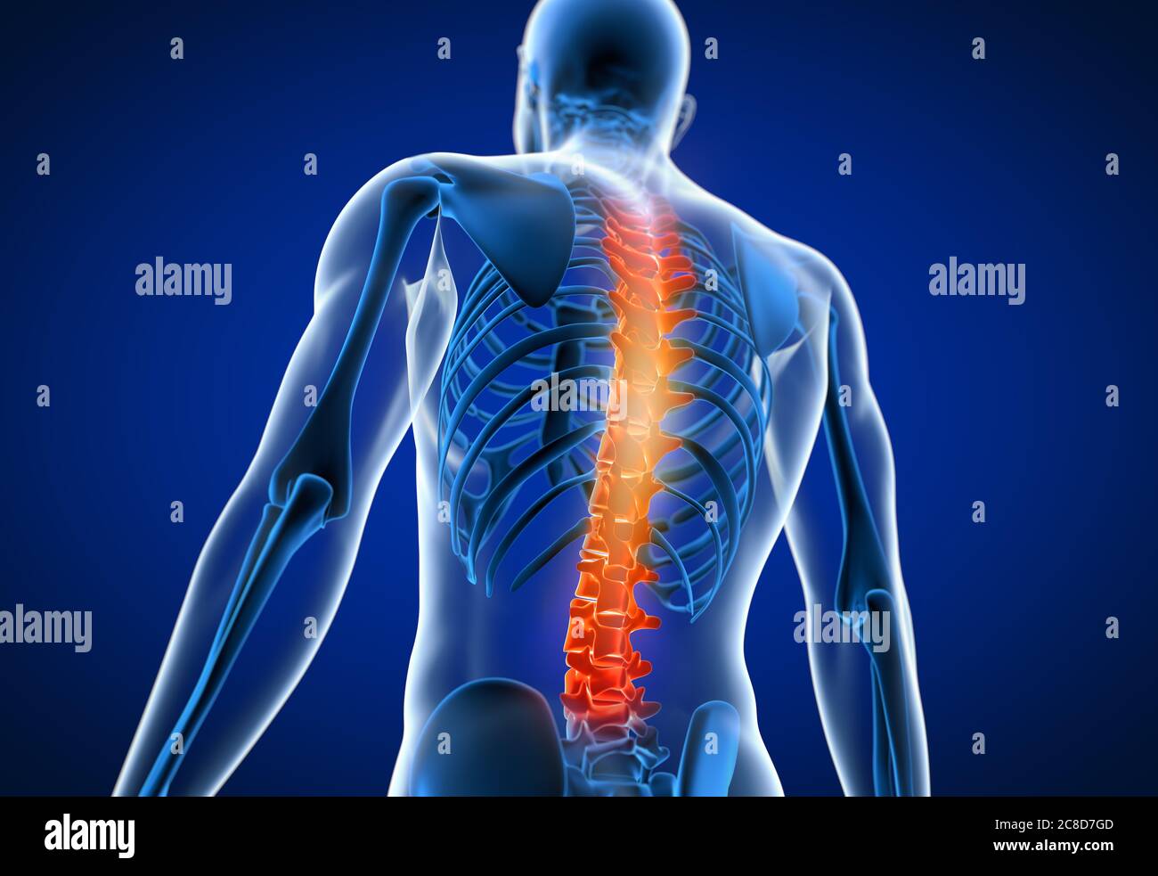 3d-Darstellung medizinisch genaue Darstellung eines Mannes mit einem schmerzhaften Rücken. Stockfoto