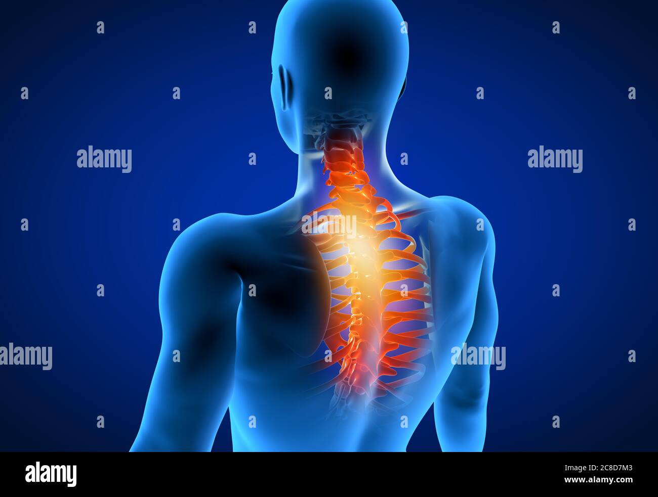 3d-Darstellung medizinisch genaue Darstellung eines Mannes mit einem schmerzhaften Hals. Stockfoto