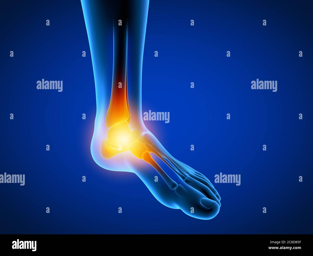 3d-Darstellung medizinisch akkurate Darstellung eines Mannes mit einem schmerzhaften Fuß. Stockfoto
