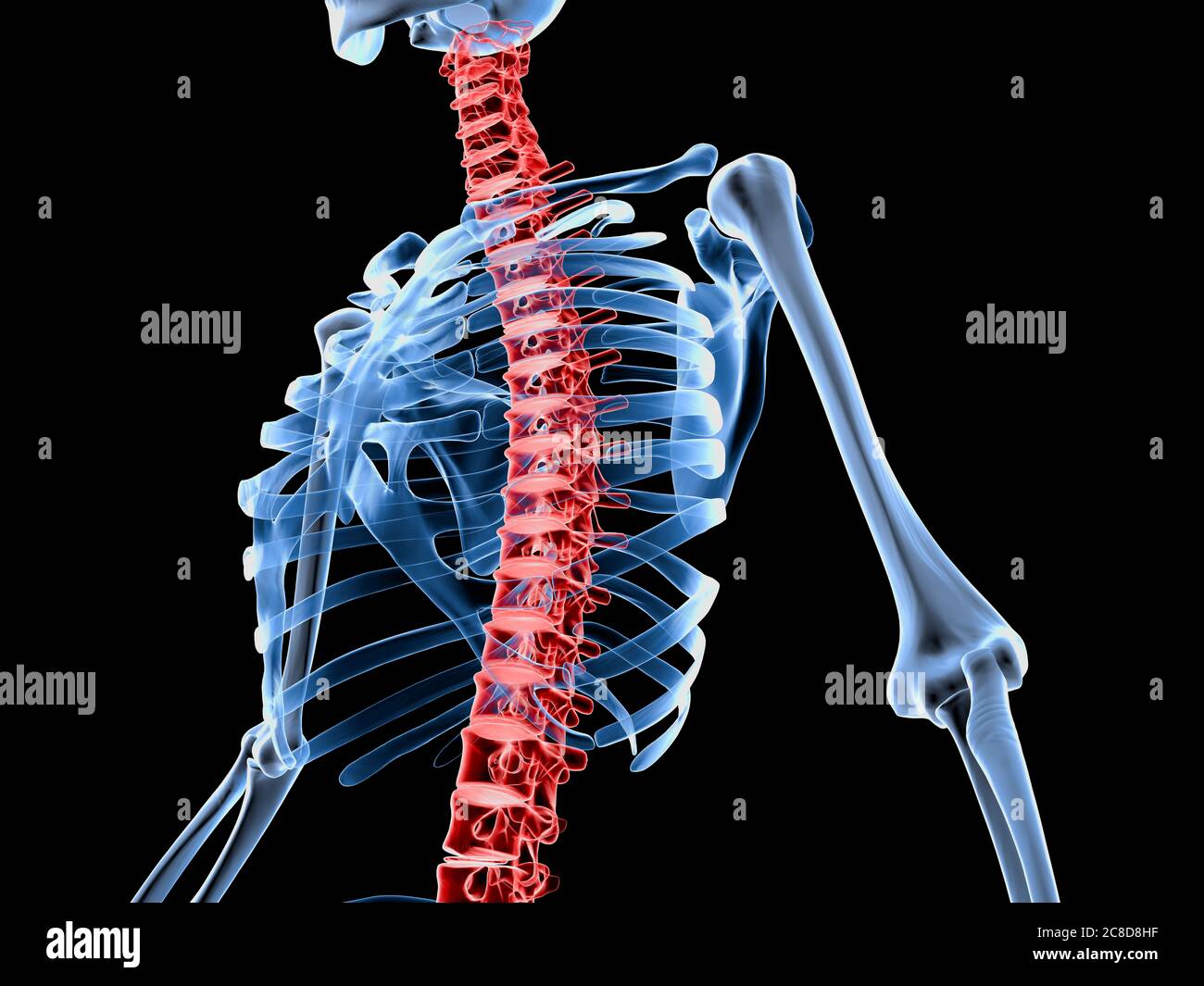 3d-Darstellung medizinisch akkurate Darstellung eines Skeletts mit schmerzhafter Rückenwirbelsäule. Stockfoto