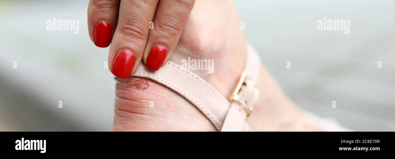 Schöne Sommerschschuhe in heller Farbe Stockfoto