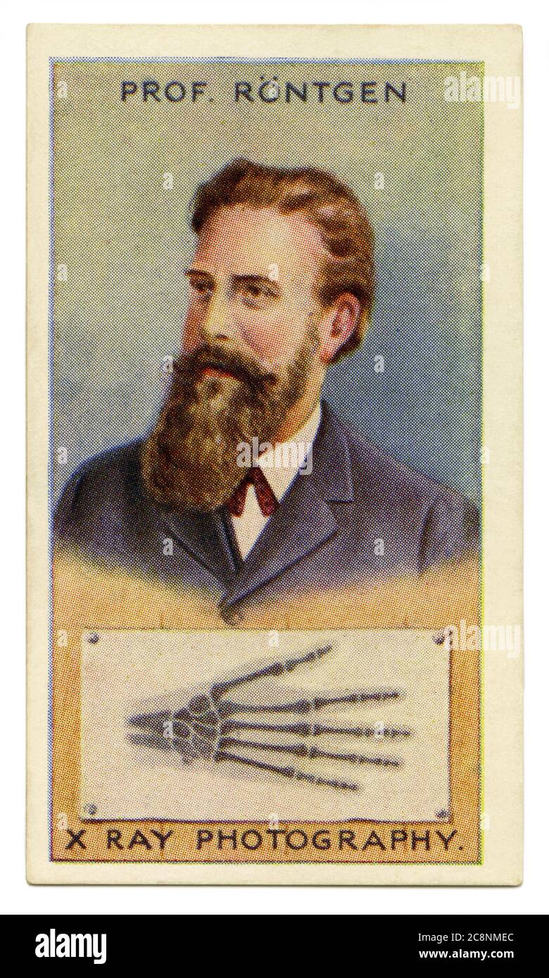 Eine alte Zigarettenkarte (c. 1929) mit einem Porträt von Wilhelm Conrad Röntgen (1845–1923) und einer Darstellung eines Röntgenstrahls der Knochen einer menschlichen Hand. Röntgen war ein deutscher Maschinenbauingenieur und Physiker, der 1895 elektromagnetische Strahlung in einem Wellenlängenbereich, der als Röntgenstrahlen oder Röntgenstrahlen bekannt ist, produzierte und entdeckte.das brachte ihm 1901 den ersten Nobelpreis für Physik ein. Röntgen sah das erste Röntgenbild: Sein eigenes Skelett auf dem Bariumplatinozyanid-Bildschirm. Einige Wochen nach seiner Entdeckung machte er ein Foto (eine Röntgenaufnahme) mit Röntgenstrahlen der Hand seiner Frau. Stockfoto