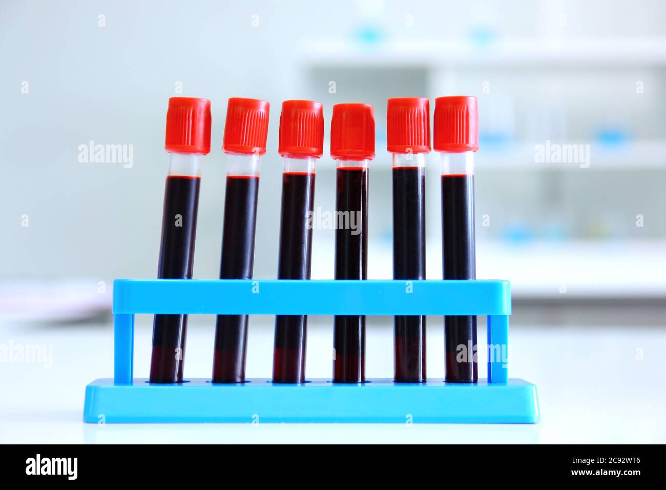 Blutprobenschlauch vom Patienten im Labor. Stockfoto