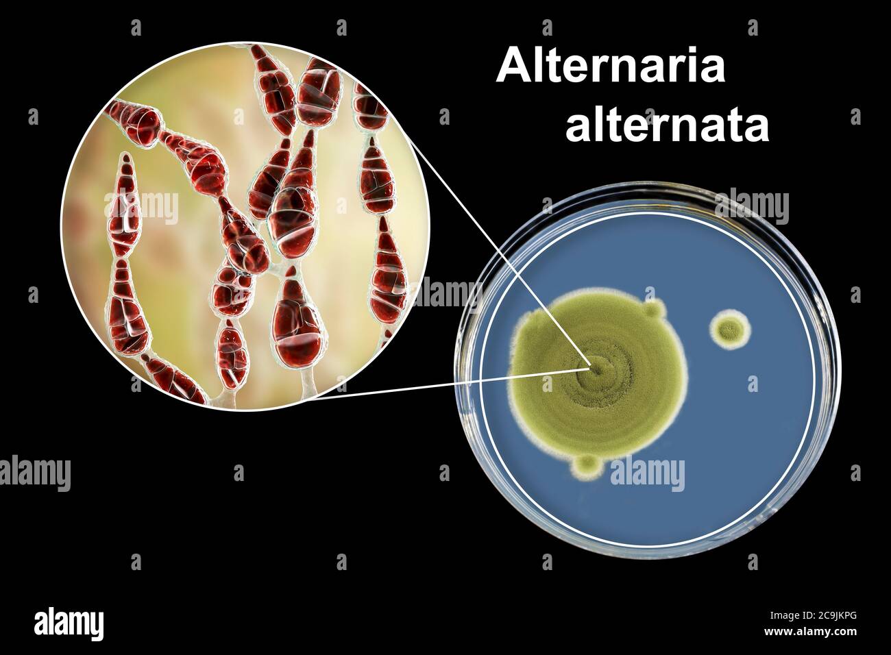 Filamentöser allergischer Pilz Alternaria alternata, Computerdarstellung der Pilzmorphologie und Aufnahme von Pilzkolonien auf Sabouraud Dextrose Stockfoto