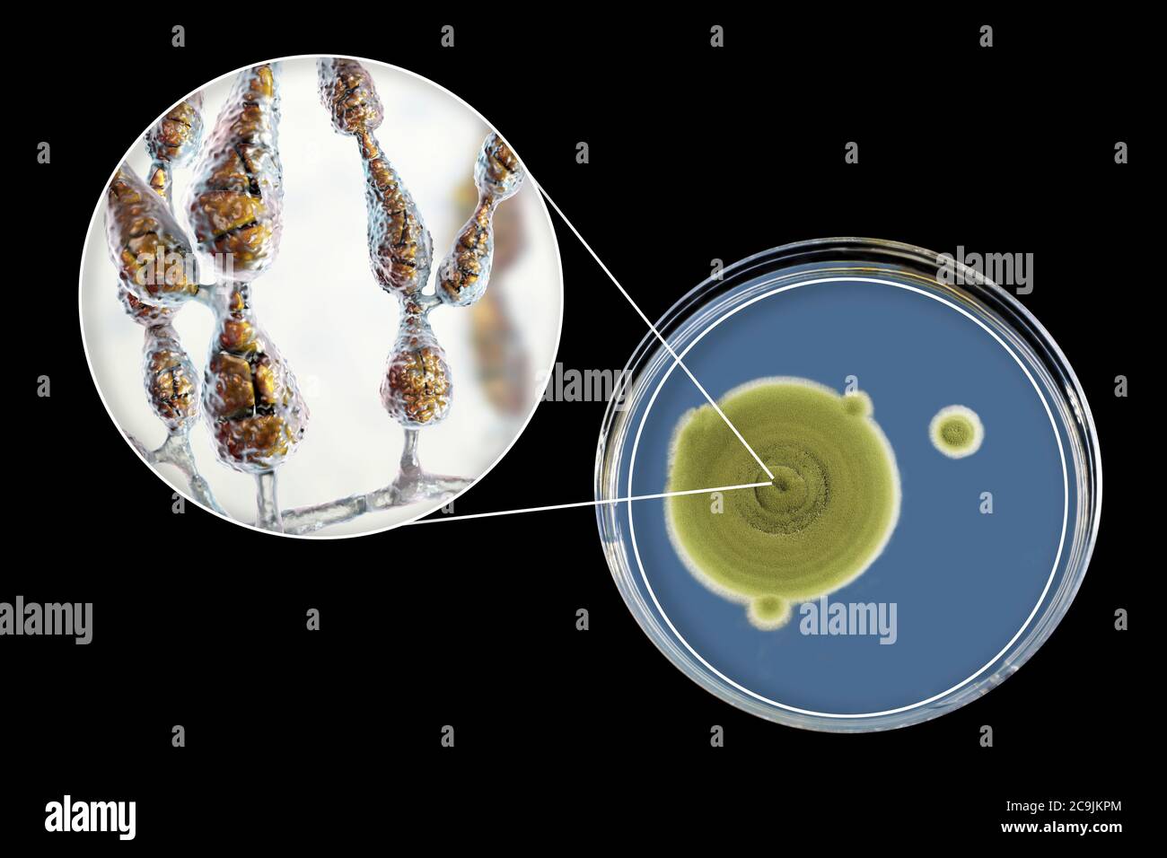 Filamentöser allergischer Pilz Alternaria alternata, Computerdarstellung der Pilzmorphologie und Aufnahme von Pilzkolonien auf Sabouraud Dextrose Stockfoto