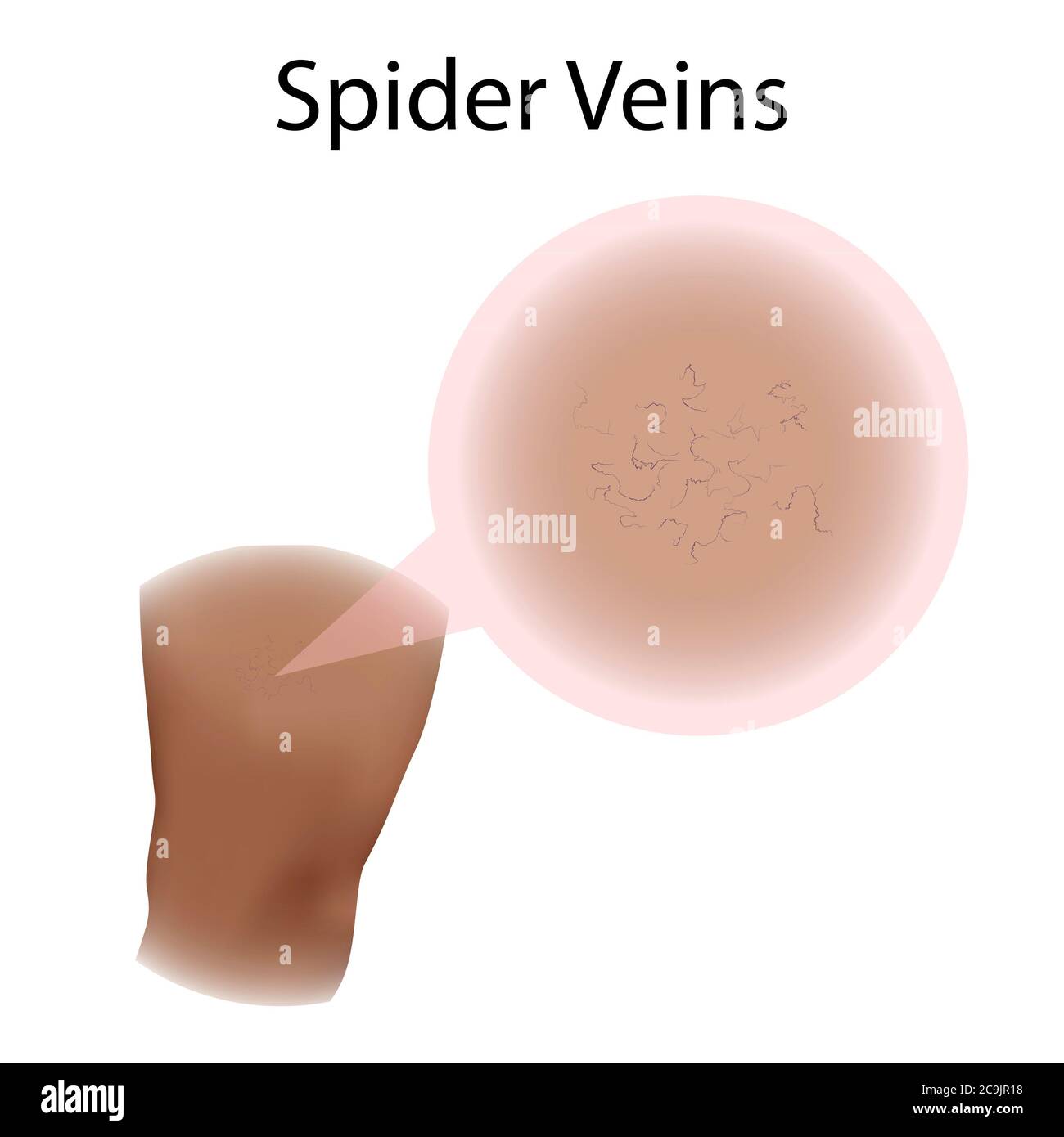 Spinnvenen, Illustration. Stockfoto