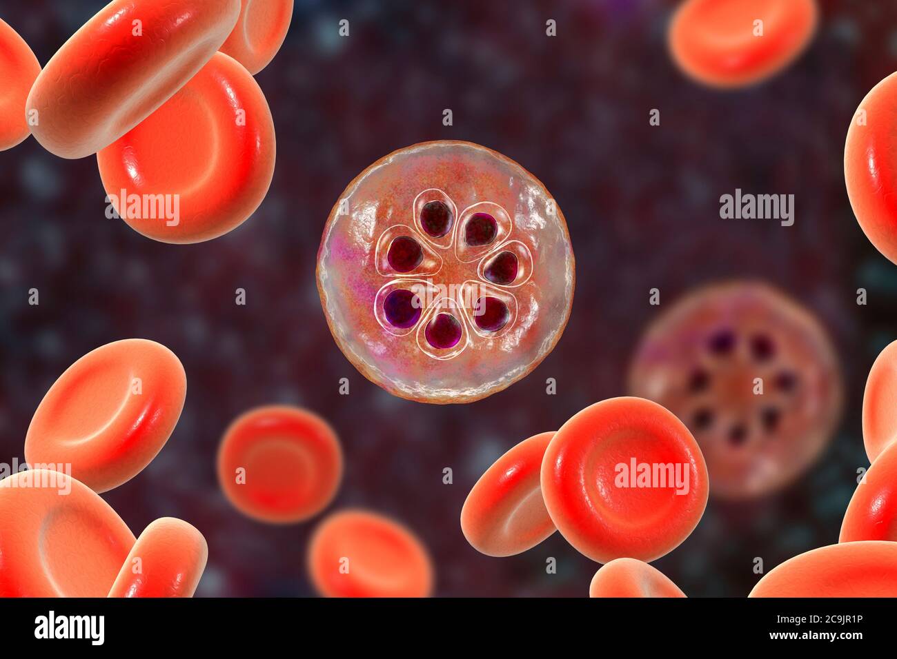 Plasmodium malariae protozoan in roten Blutkörperchen, Computer-Illustration. P. malariae ist der Erreger der Quaranmalaria, auch mala genannt Stockfoto