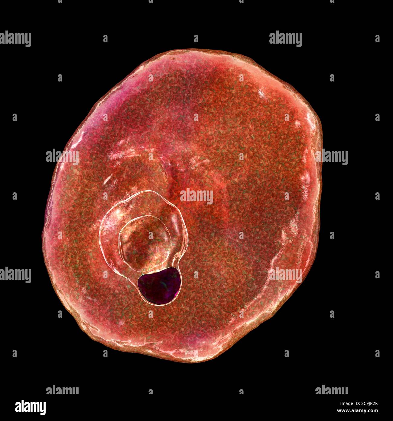 Plasmodium ovale protozoan innerhalb der roten Blutkörperchen, Computer-Illustration. P. ovale ist der Erreger der gutartigen tertianischen Malaria, auch oval genannt Stockfoto