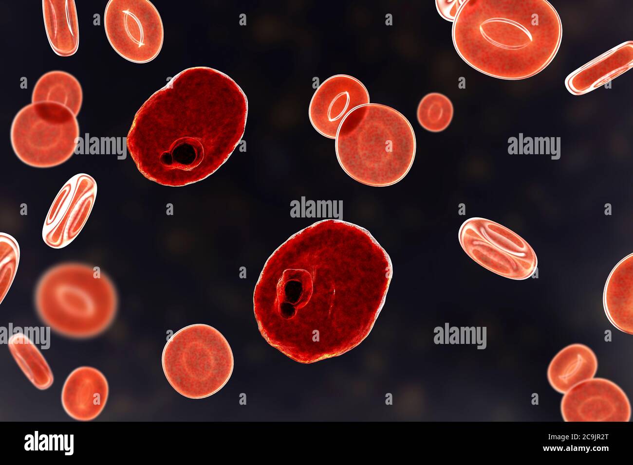 Plasmodium ovale Protozoan in roten Blutkörperchen, Computer-Illustration. P. ovale ist der Erreger der gutartigen tertianischen Malaria, auch als Eizellen bekannt Stockfoto