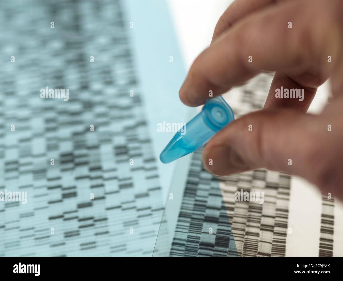 Wissenschaftler hält eine Probe vor einem DNA-Autoradiogramm (Desoxyribonukleinsäure) auf einem Leuchtkasten. Stockfoto