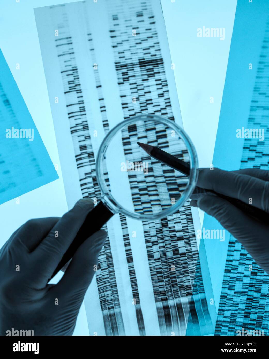 Wissenschaftler mit einer Lupe, um die Bänderung auf einem DNA-Profil (Desoxyribonukleinsäure) zu betrachten. Stockfoto