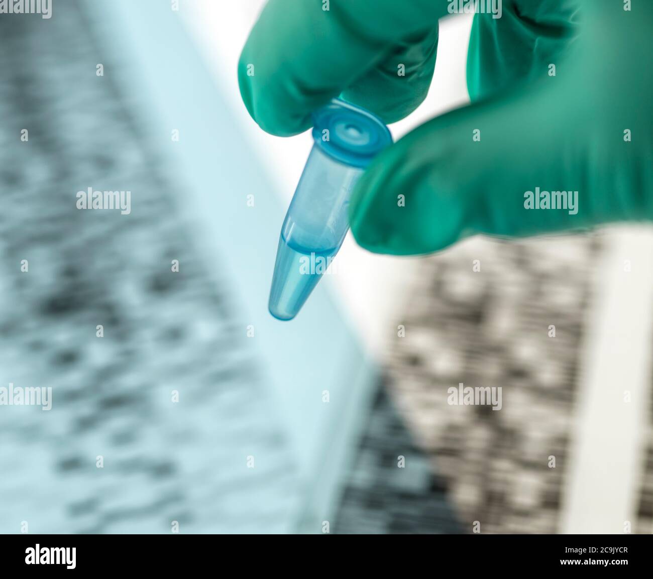 Wissenschaftler hält eine Probe vor einem DNA-Autoradiogramm (Desoxyribonukleinsäure) auf einem Leuchtkasten. Stockfoto