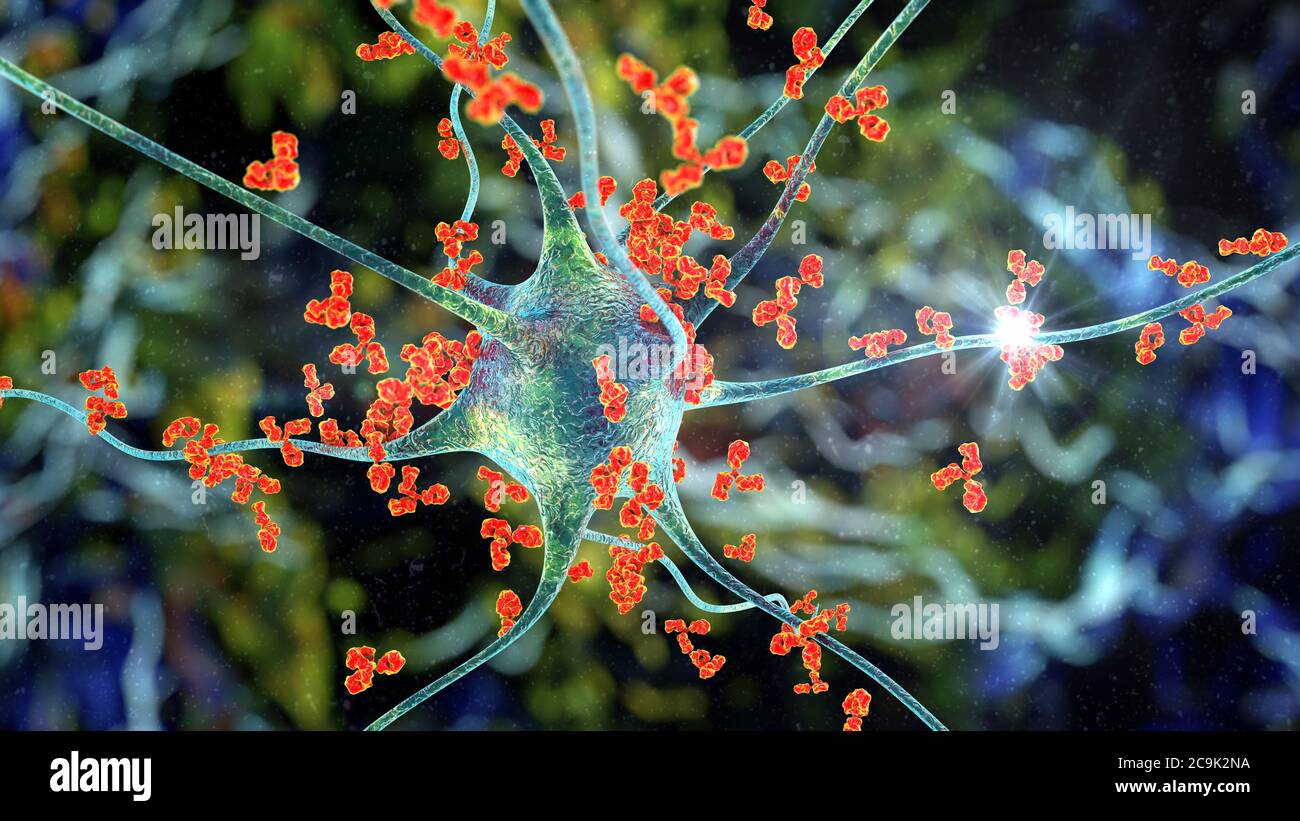 Antikörper gegen Neuronen. Konzeptionelle Computerdarstellung autoimmun neurologischer Erkrankungen. Stockfoto