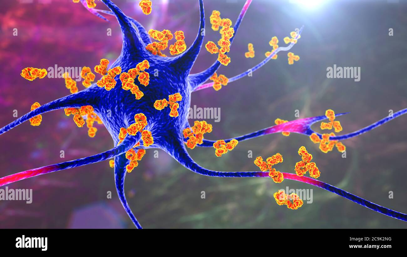 Antikörper gegen Neuronen. Konzeptionelle Computerdarstellung autoimmun neurologischer Erkrankungen. Stockfoto