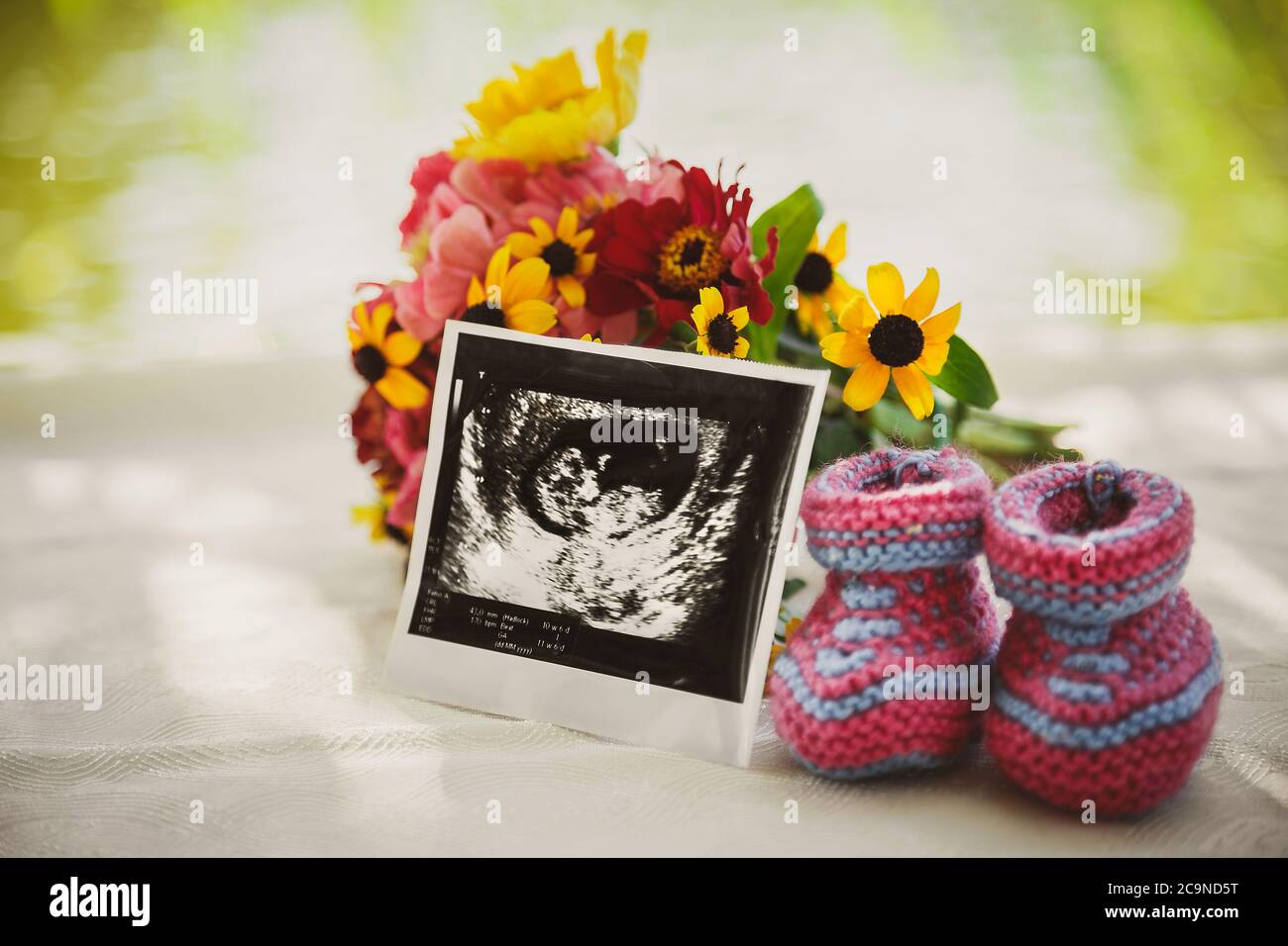 Nahaufnahme des Ultraschallbildes, Foto des zukünftigen Babys am Bauch und kleine Babyschuhe Stockfoto