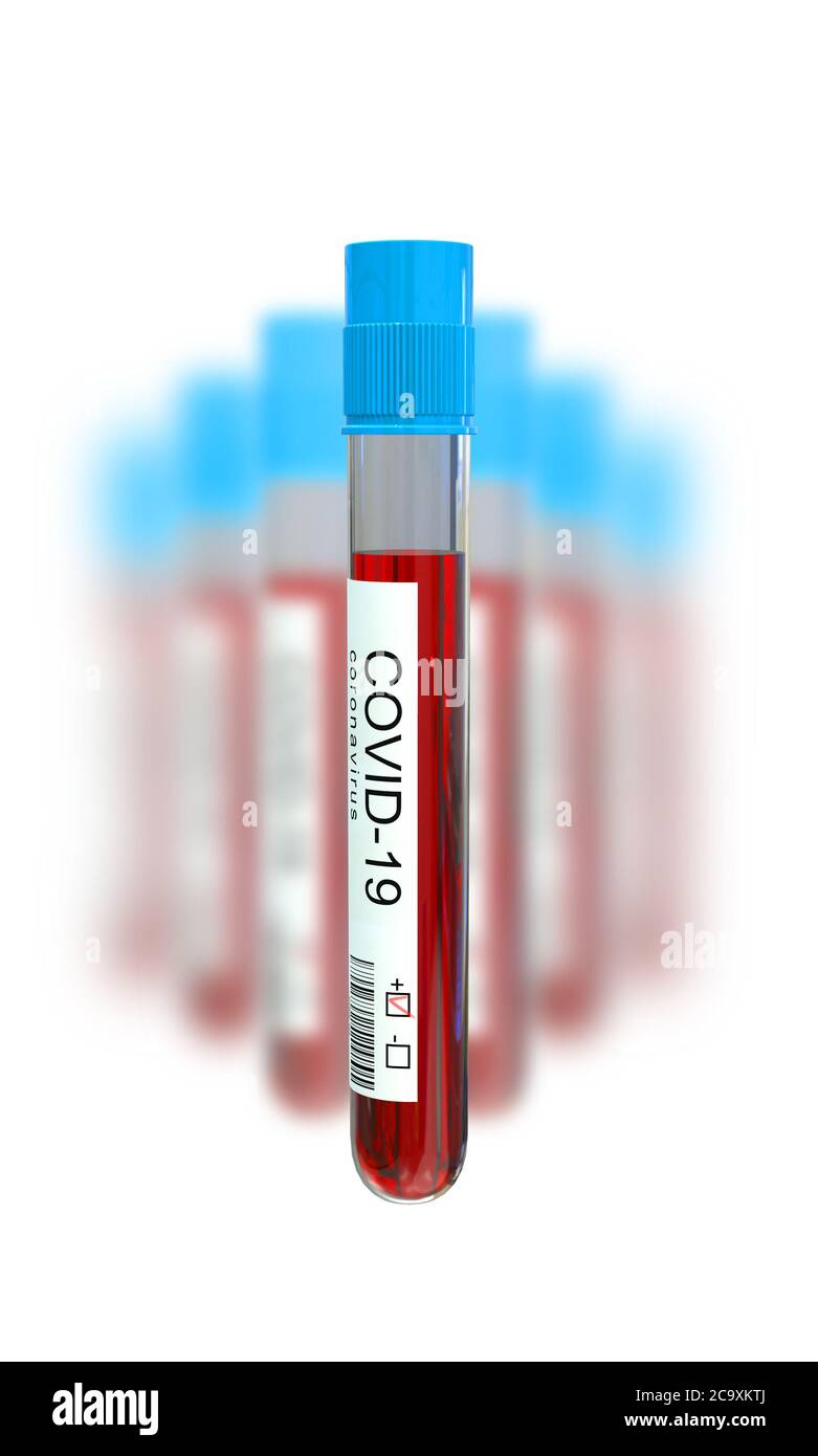 Hämatologische Vakuumteströhre mit Bluttest auf Virus COVID-19. 3d-Illustration Stockfoto