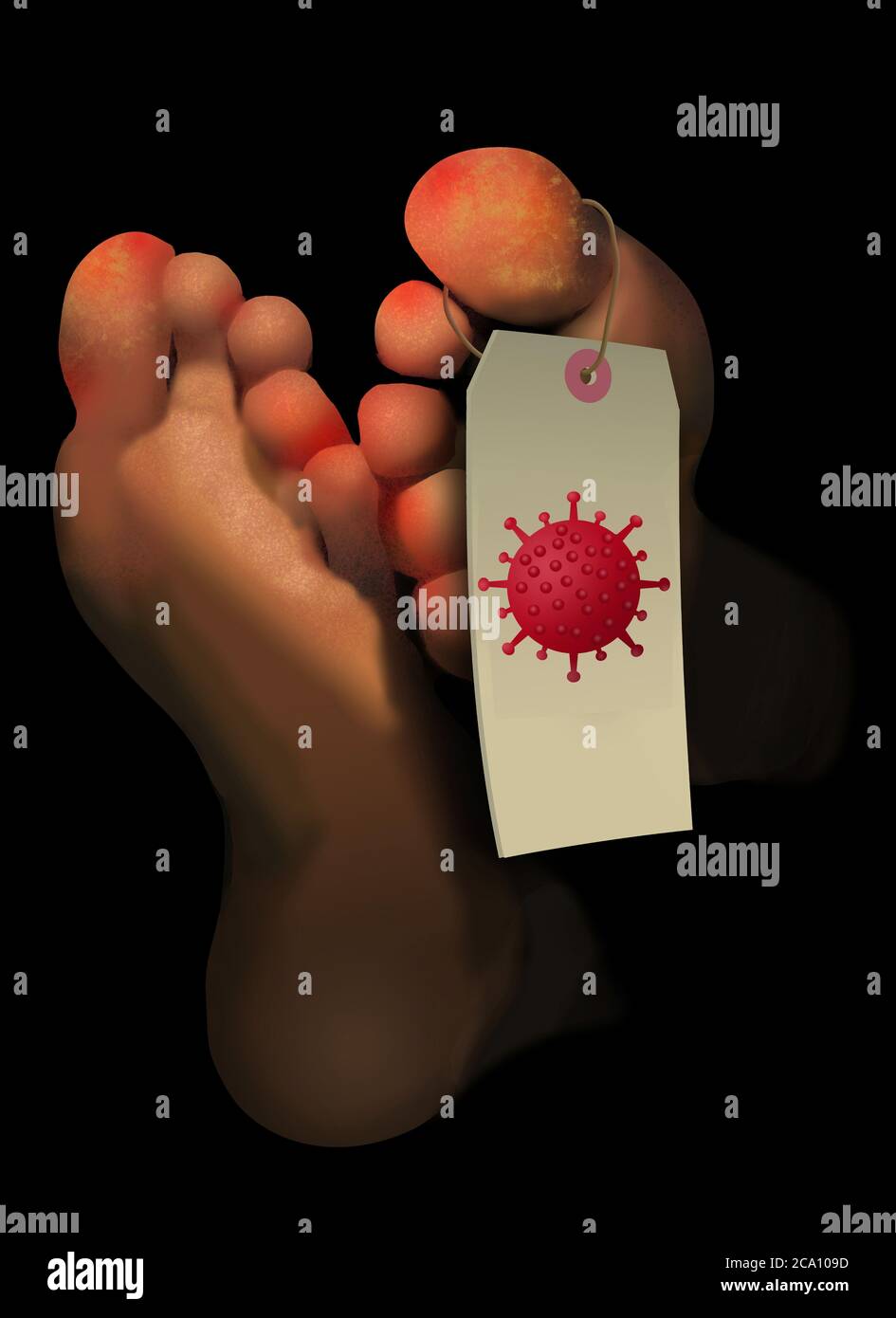 Covid Zehen Ein Roter Ausschlag Auf Den Zehen Von Coronavirus Patienten Ist In Dieser Abbildung Zu Sehen Stockfotografie Alamy