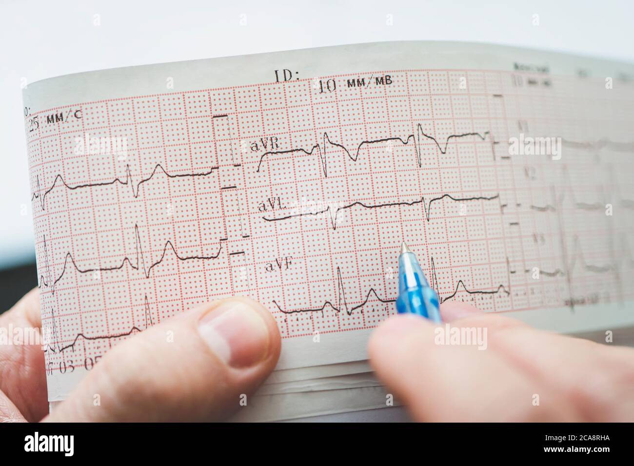 Elektrokardiogramm in den Händen des Arztes. Herz-Gesundheits-Check. Stockfoto