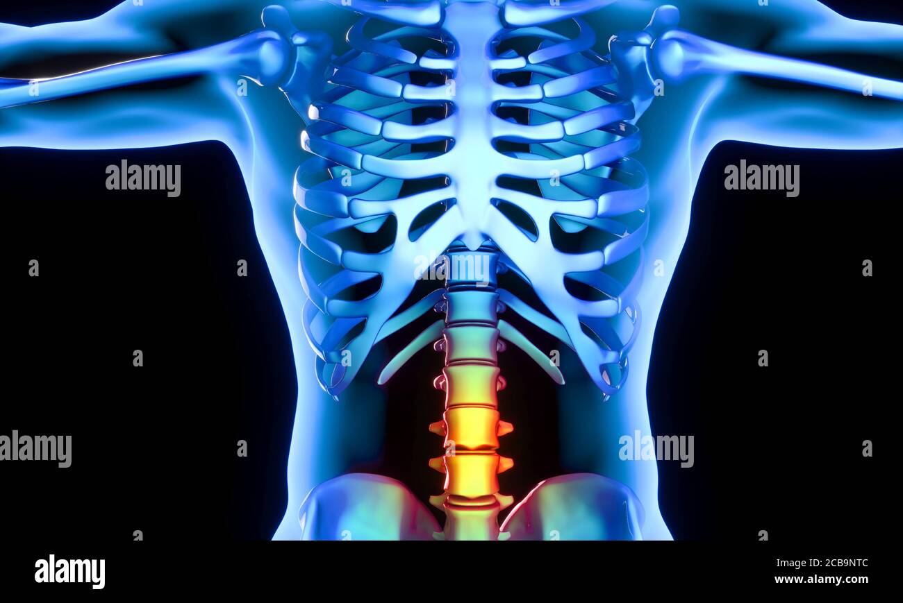 Illustrative Abbildung eines menschlichen Körpers mit dem lumbalen Teil der Wirbel, die Schmerzen und Entzündungen darstellen. 3d-Rendering. Stockfoto