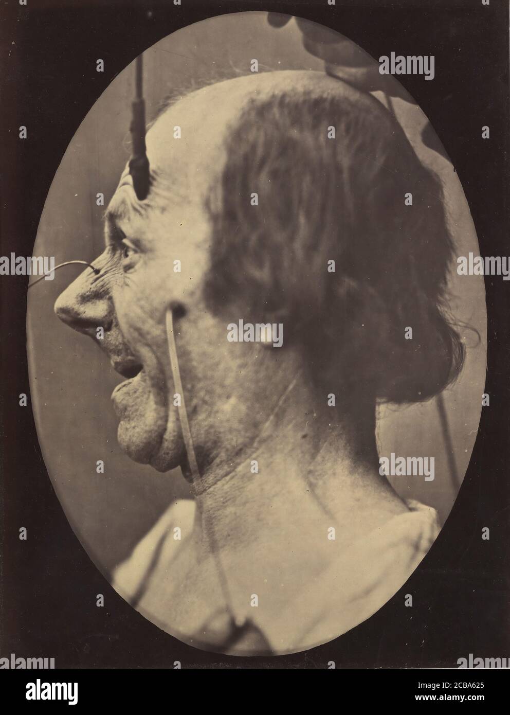 Abbildung 39: Die Aufmerksamkeit, die von einem Objekt angezogen wird, das laszive Ideen und Wünsche provoziert. , 1854-56, gedruckt 1862. Stockfoto