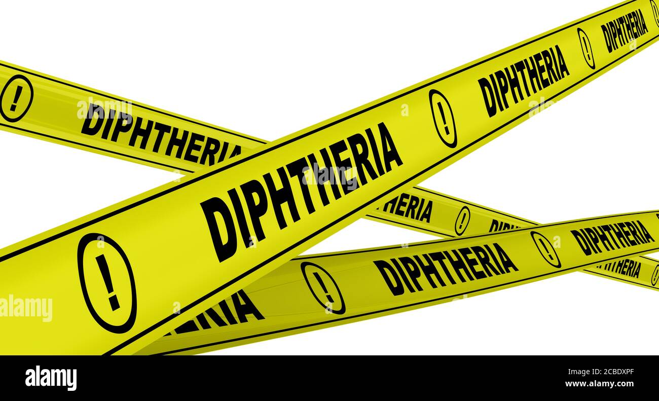 Gelbe Warnbänder mit schwarzen Worten DIPHTHERIE (eine Infektion durch das Bakterium Corynebacterium diphtheriae). Isoliert. 3D-Illustration Stockfoto