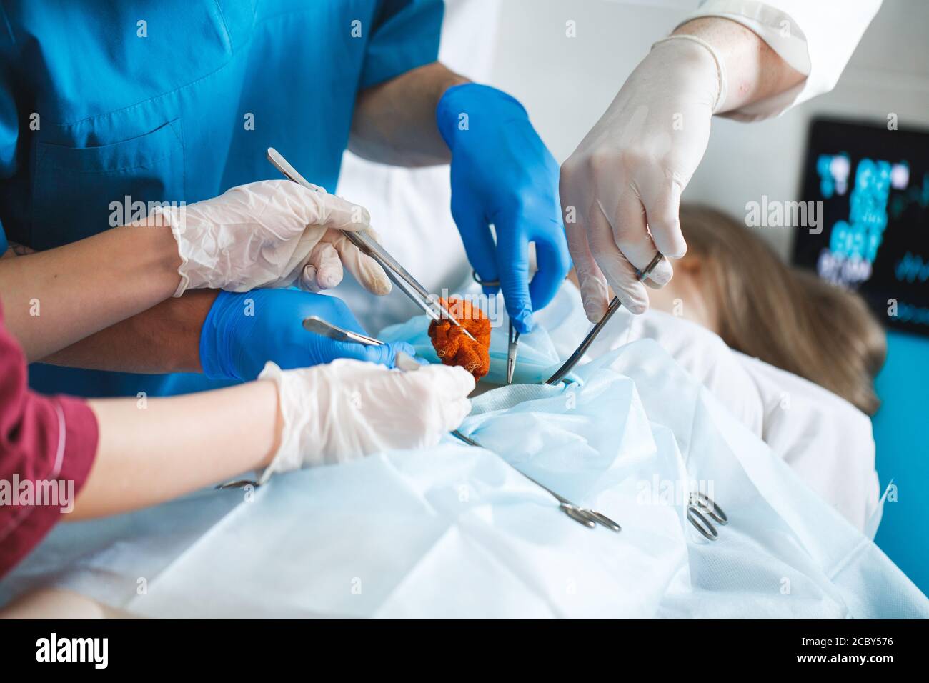 Nahaufnahme Detail einer Operation. Gruppe von Chirurgen bei der Arbeit im Op. Stockfoto
