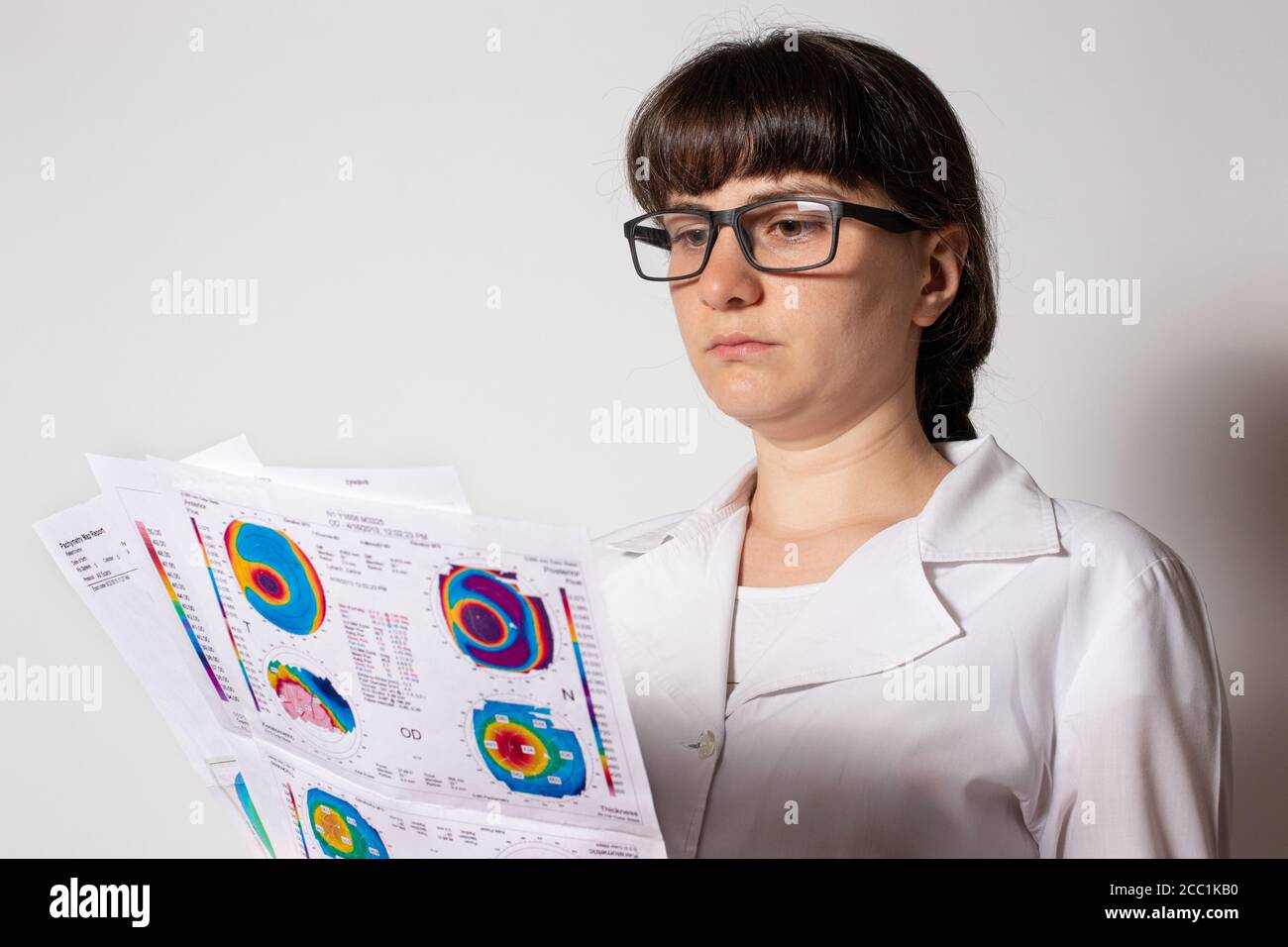 Dünner werdendes Hornhautdystrophie, Augen-Keratotopographie. Stockfoto