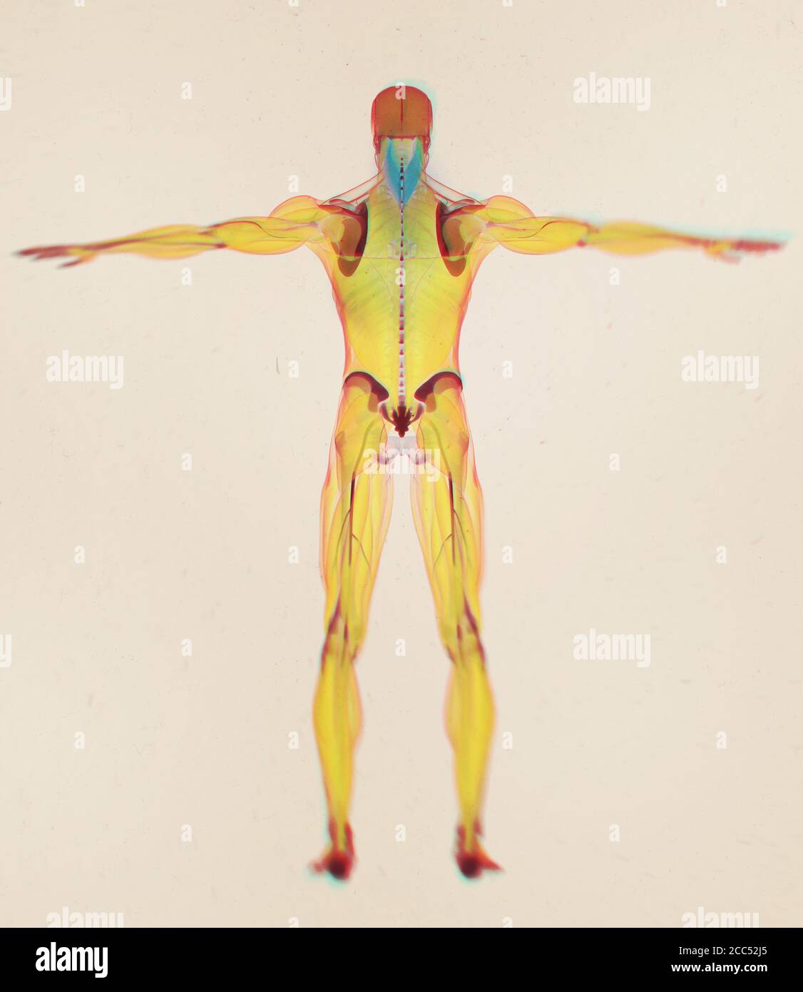 Splenius capitis, Nackenmuskulatur, Stress, menschliche Anatomie. 3D-Illustration Stockfoto