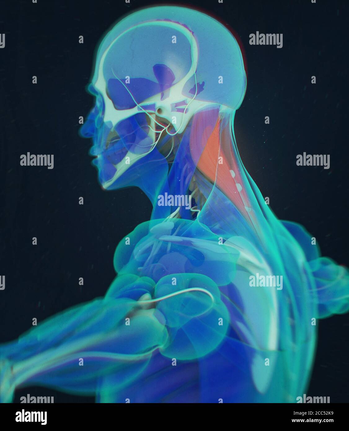 Splenius capitis, Nackenmuskulatur, Stress, menschliche Anatomie. 3D-Illustration Stockfoto