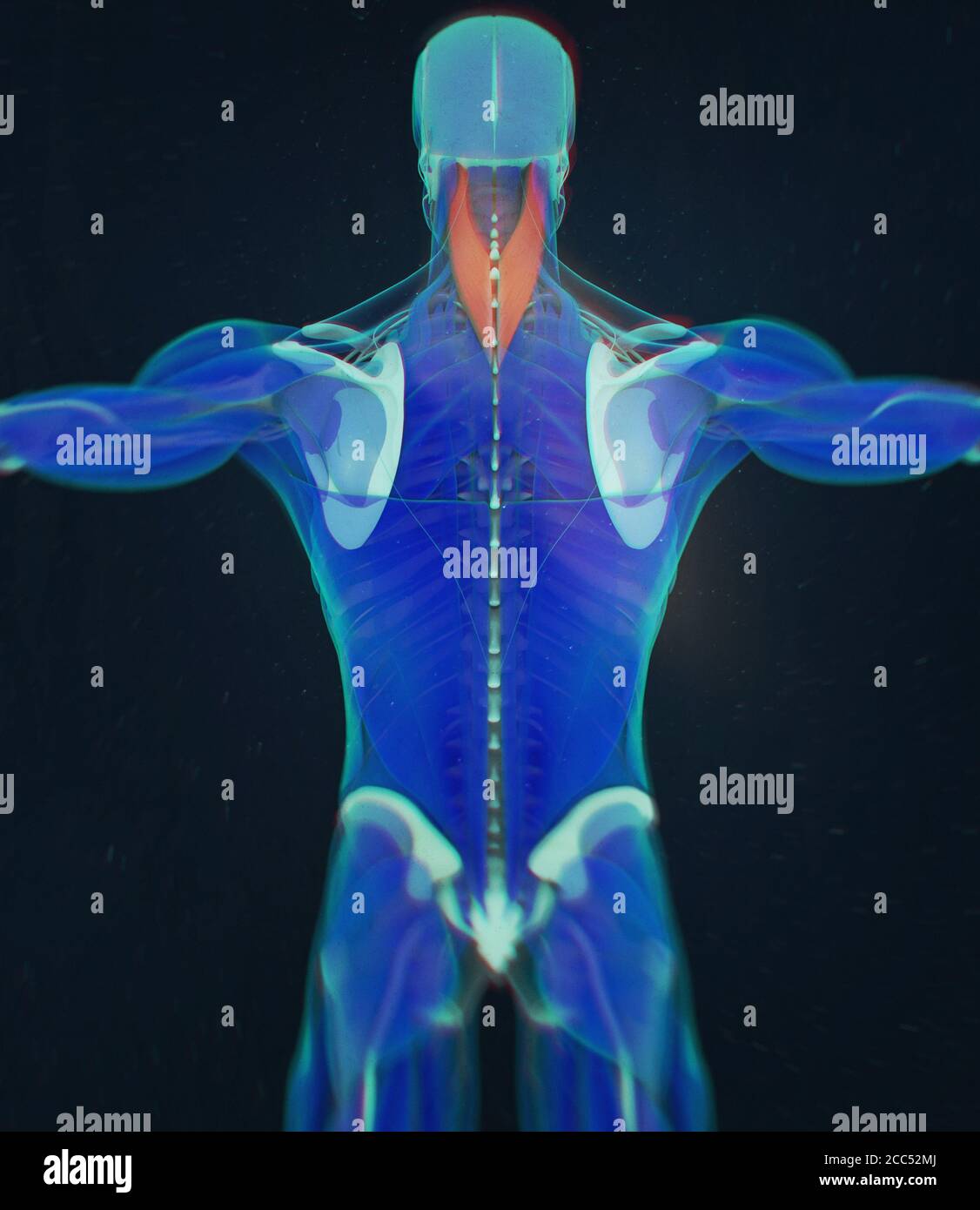Splenius capitis, Nackenmuskulatur, Stress, menschliche Anatomie. 3D-Illustration Stockfoto