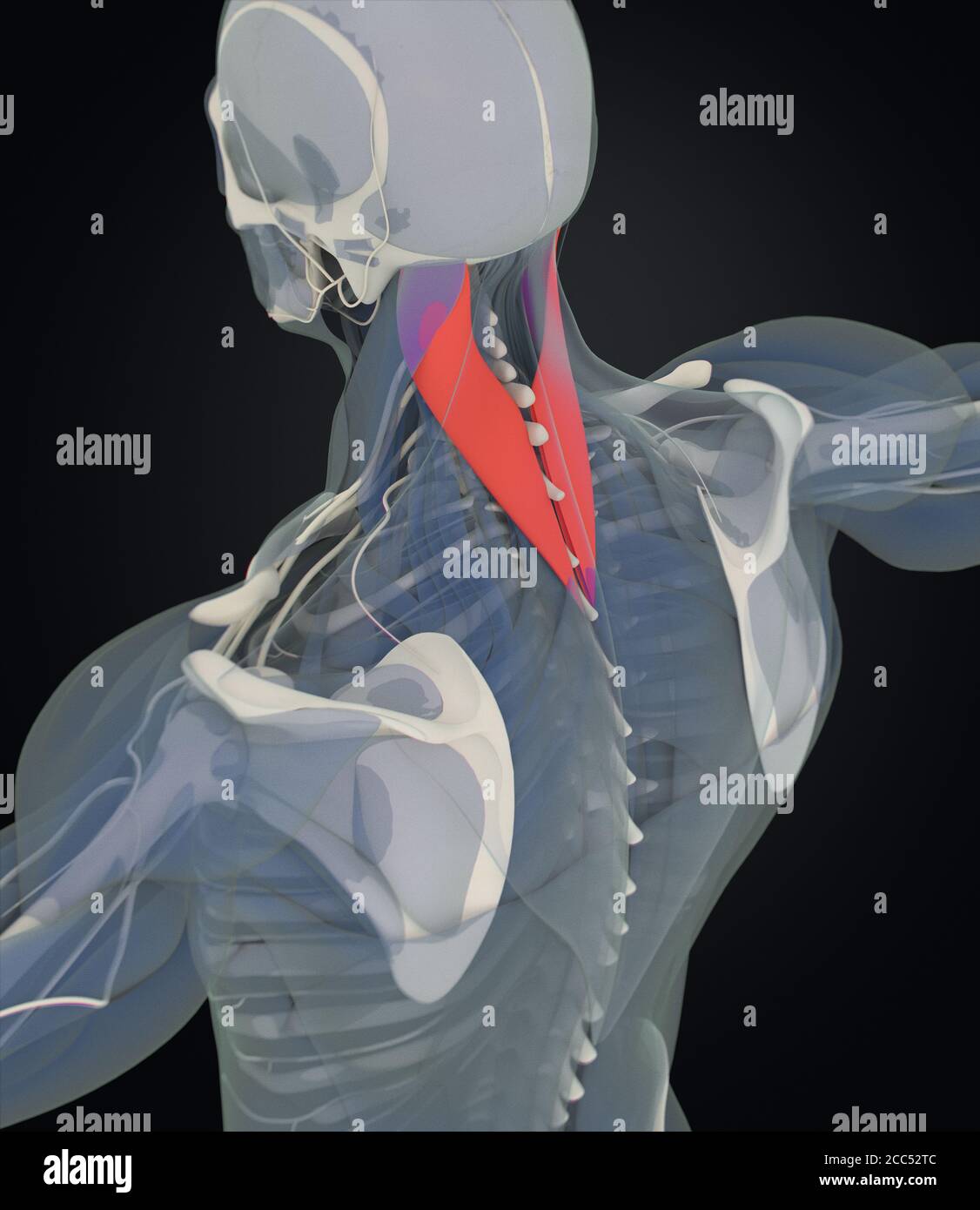 Splenius capitis, Nackenmuskulatur, Stress, menschliche Anatomie. 3D-Illustration Stockfoto