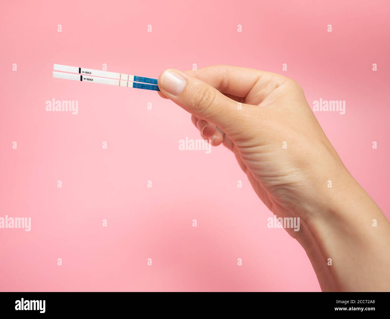 Positiver schwangerschaftstest durch zyste