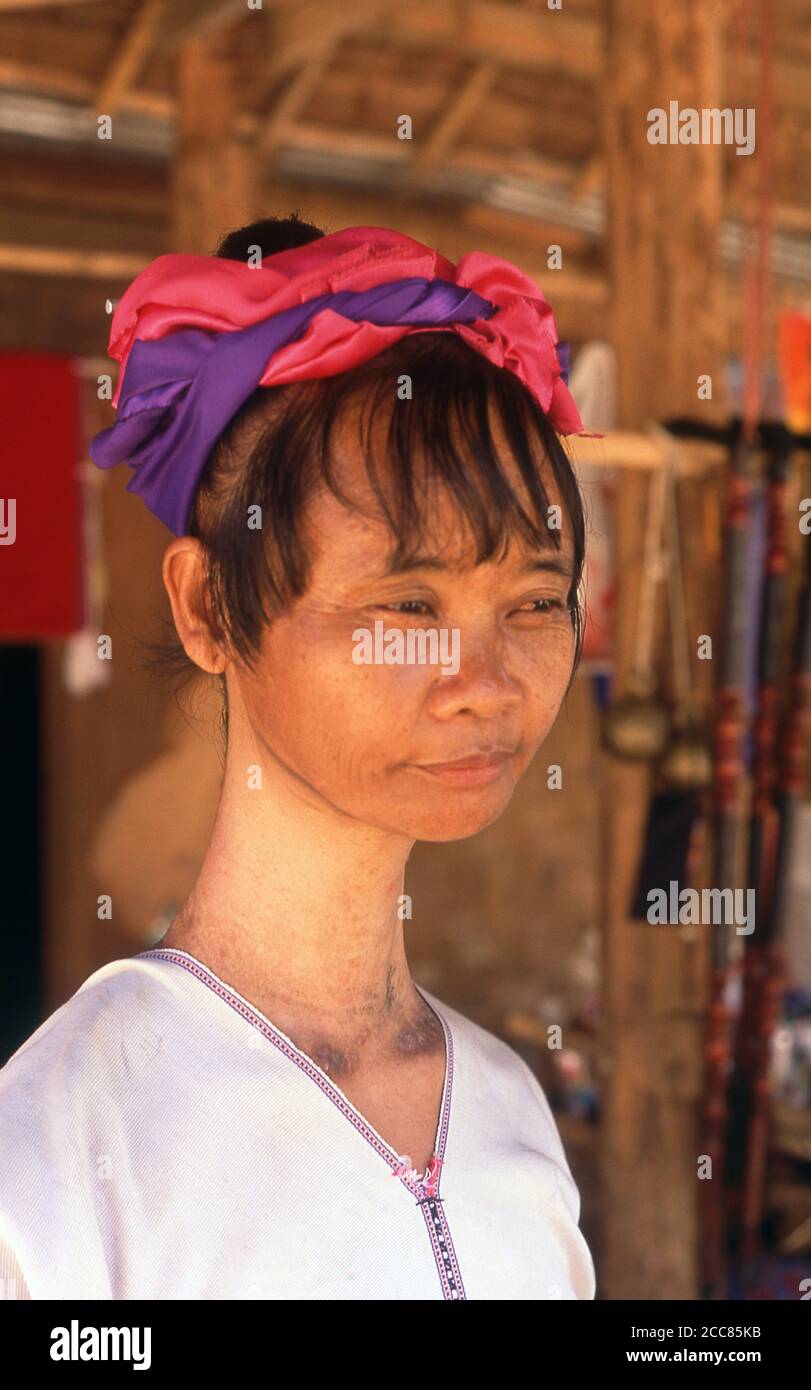 Thailand: Eine Padaung (Long Neck Karen) Frau, nachdem sie ihre Halsringe zum Reinigen entfernt hatte, Dorf in der Nähe von Mae Hong Son. Die Padaung oder Kayan Lahwi oder langhalsige Karen sind eine Untergruppe der Kayan, eine Mischung aus gesetztem, Kayan und mehreren anderen Stämmen. Kayan sind eine Untergruppe der Roten Karen (Karenni), einer tibeto-burmanischen ethnischen Minderheit in Burma (Myanmar). Stockfoto