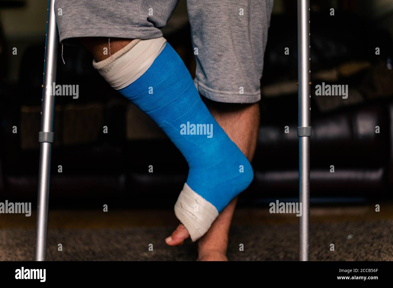 Gipsverband krankenhaus bein mann -Fotos und -Bildmaterial in hoher ...