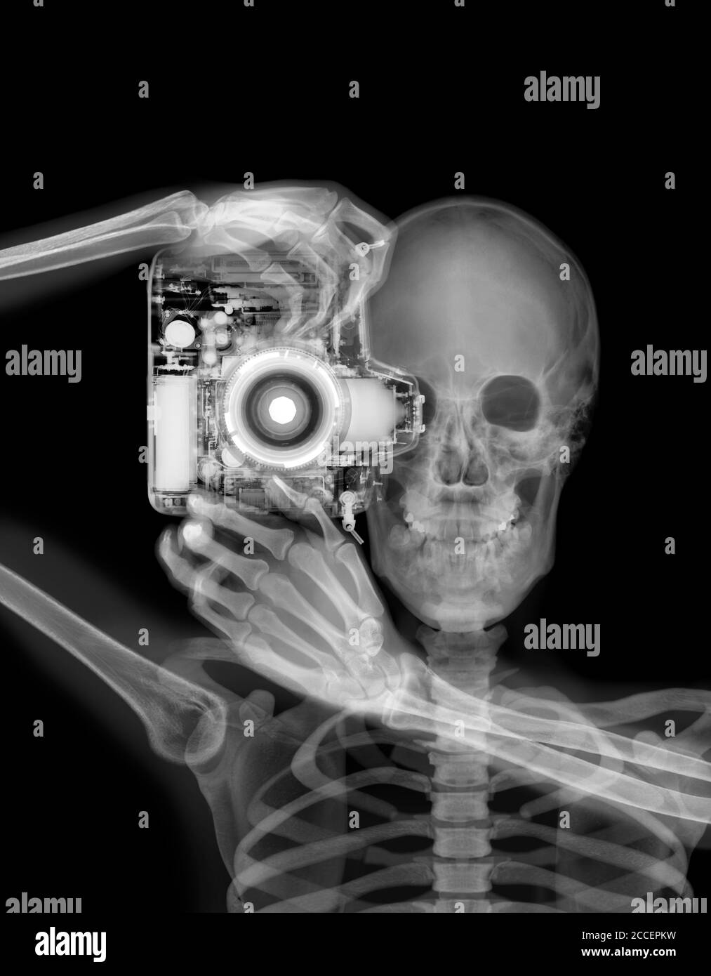 Skelett und Kamera, Röntgen Stockfoto