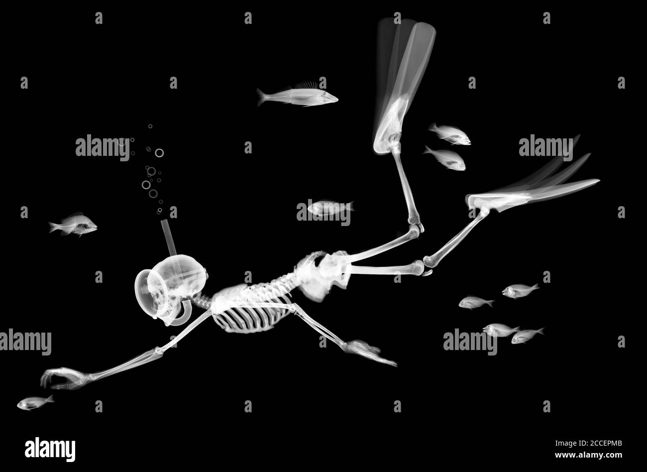 Skeleton Tauchen unter Fischen, Röntgen Stockfoto