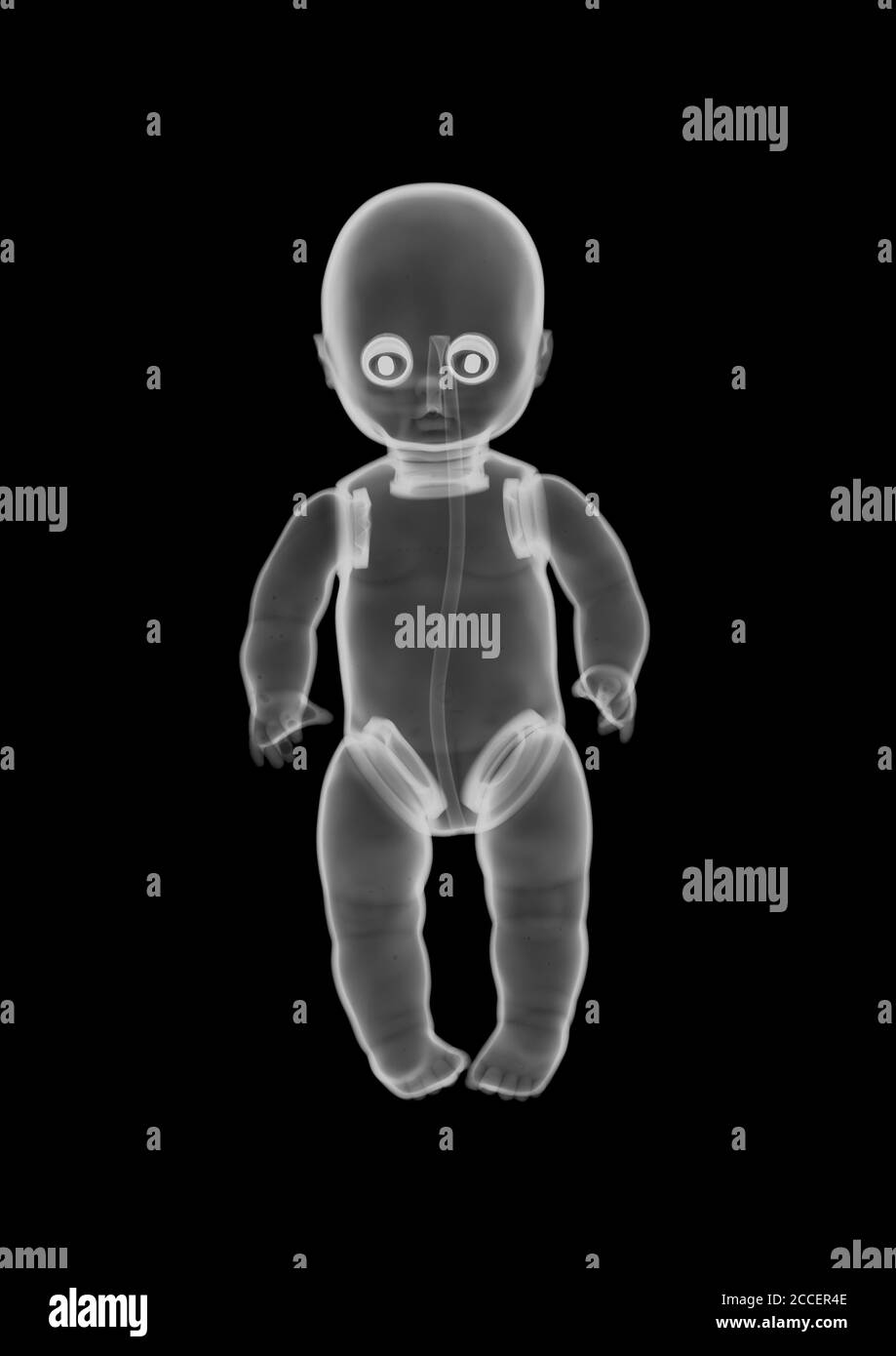 Kunststoff Baby Puppe Spielzeug, X-ray Stockfoto