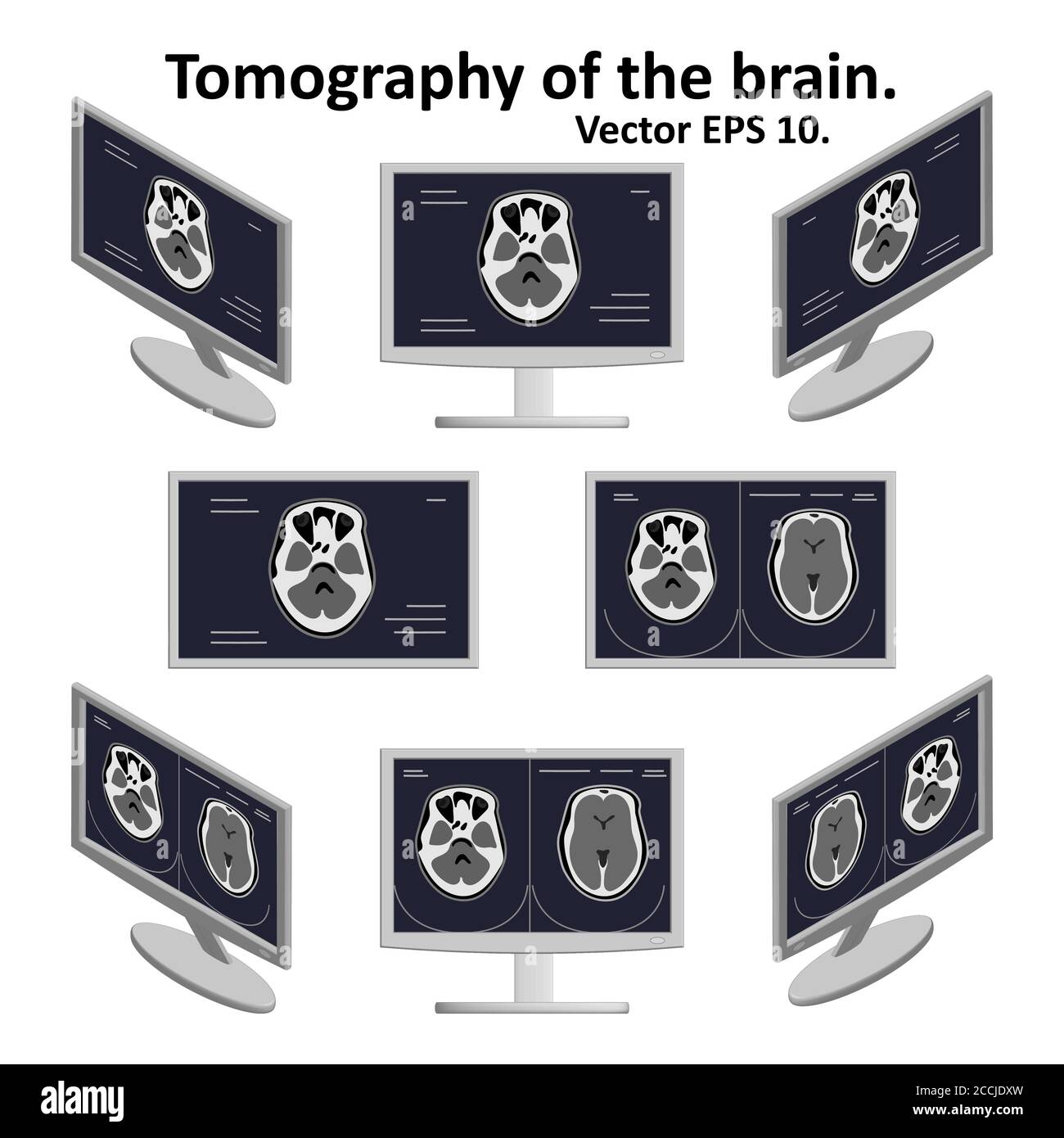 Satz von Querschnitt des Gehirns während der Magnetresonanztomographie auf einem Computerbildschirm in isometrischer Ansicht. Ein paar Bilder vom Bild des Gehirns. Stock Vektor