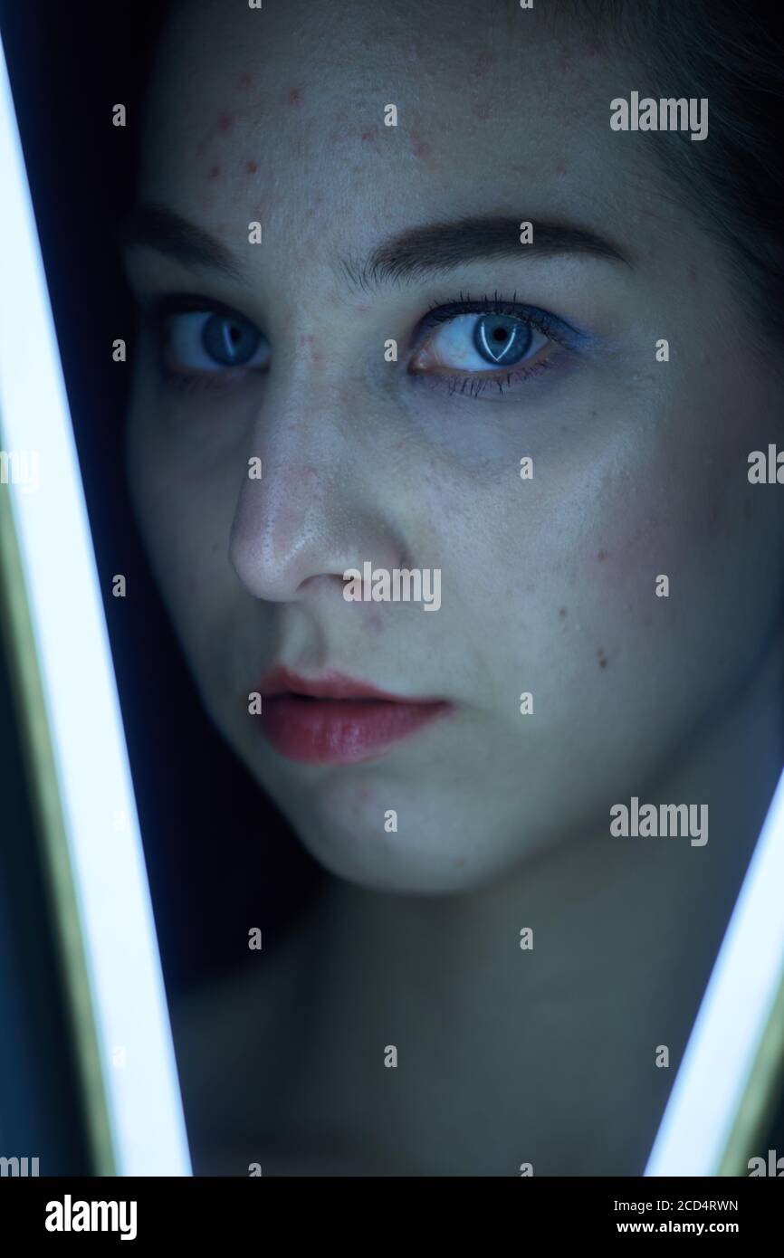 Traurige junge Frau mit pimpeliger Haut in Neonlicht suchen Bei der Kamera Stockfoto