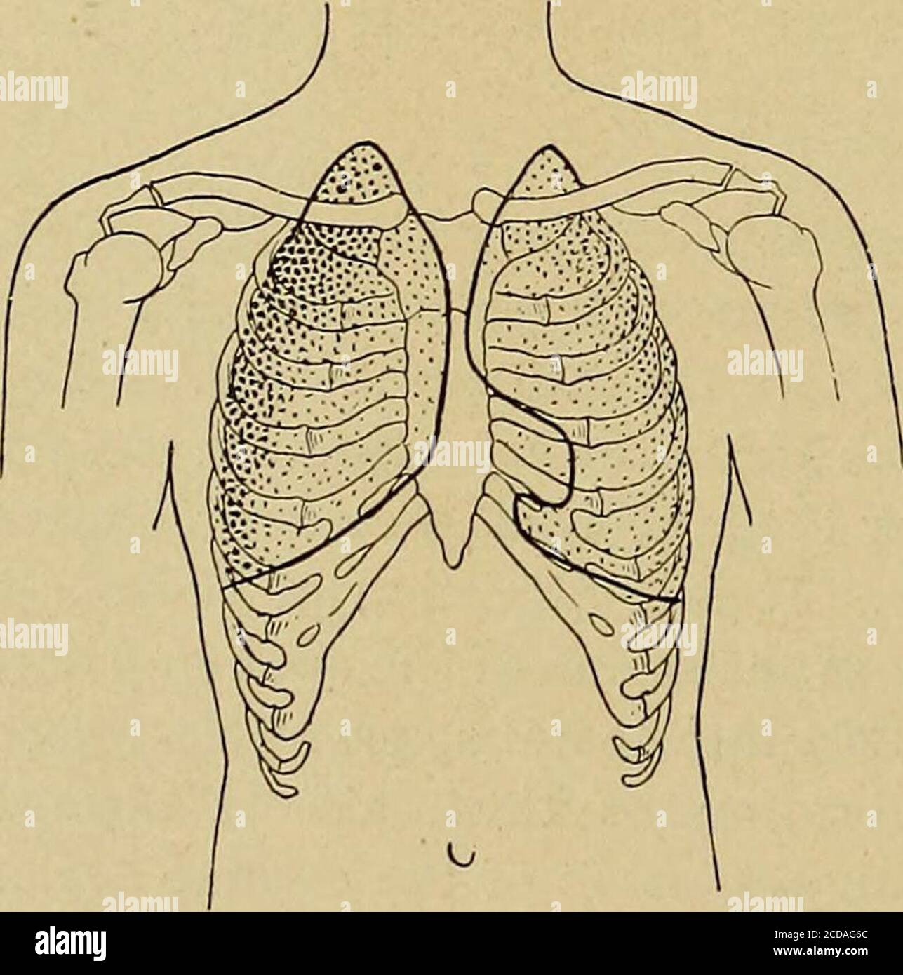 . Körperliche Diagnose . e Patient immer die Formel wiederholen. So ist es wahrscheinlich, dass er jedes Mal, wenn er sie wiederholt, dieselbe Kraft verwendet und ungefähr die Samepitch der Stimme verwendet. Andere Dinge gleich, thefremitus ist größer bei Männern als bei Frauen, bei Erwachsenen als bei Kindern, und ist mehr ausgeprägt indiejenigen, deren Stimmen sind tief als in denen, die relativ schrill sind. Die Menge des Fremitus variiert auch in verschiedenen Teilen der gesunden Brust. Ein Blick auf Abb. 86 wird uns helfen, dies zu erkennen. Die Teile schattiert dunkelsten communi-cate, um die Finger die am meisten markierten Fremitus, w Stockfoto