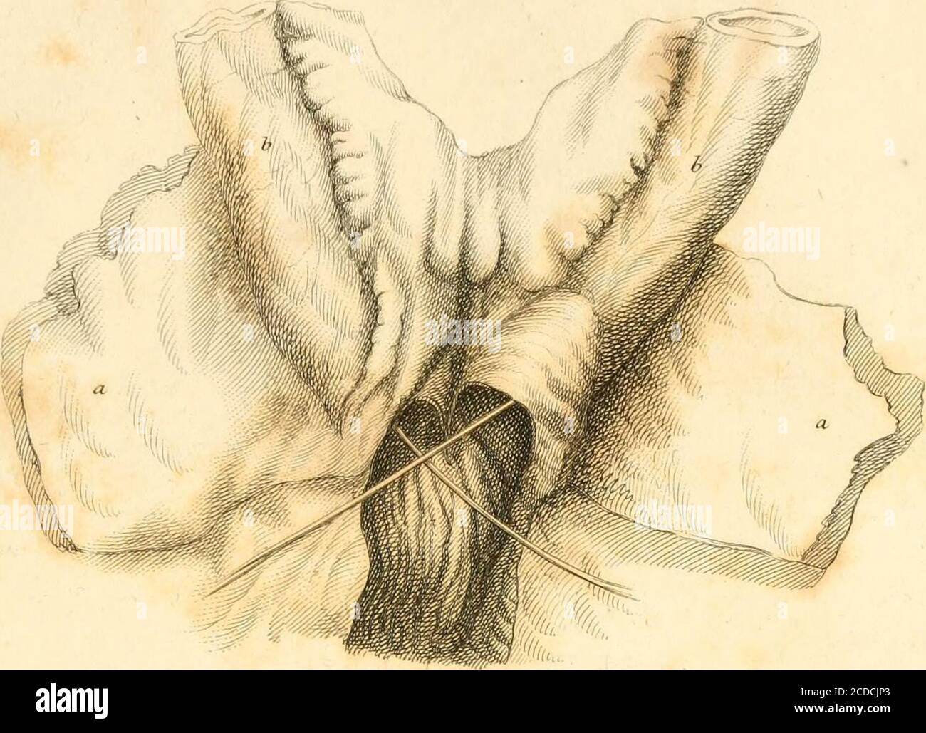 . Eine Untersuchung über den Prozess der Natur bei der Reparatur von Verletzungen des Darms: Veranschaulichen die Behandlung von durchdringenden Wunden und strangulierten Hernie . LANATION DER PLATTEN. PLATTE VI. Abb. 1 stellt die Vorderansicht der Extremitäten des Darms in einer gestürzten Hernie dar, in der sich die Striktur Vas- freiberuflich am vierzehnten Tag der Operation teilte. Ein in der Striktur enthaltenes Stück von Omentum hatte sich getrennt. a. rt – das Peritoneum, das die Psoas und Iliacmuscles bedeckte. b. b – die zwei Teile des Darms, die durch das mesentery verbunden und durch sehr starke butdefined adhe in einer eckigen Position fixiert wurden Stockfoto