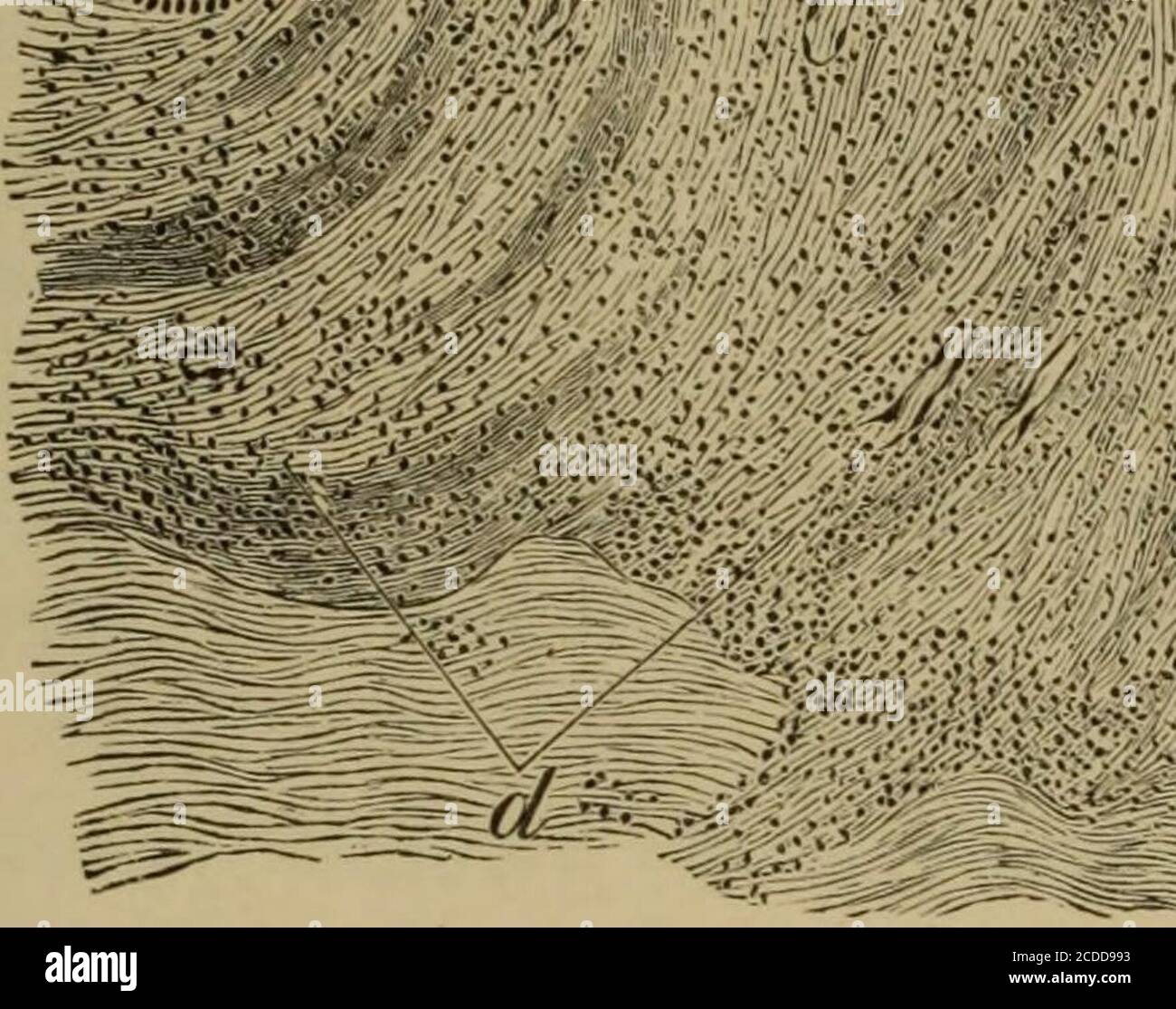 . Die Elemente der pathologischen Histologie mit besonderem Bezug auf praktische Methoden . 0 ?•:{ .?, .;**i>SV- • •. MIIS«:! fe^# :^^^:?:^-^^--S^-- ??-?-? ^iiiifei//:- Abb. 203. – Condyloma Latum, x 95. (Alaun cochineal.) «, Stratum corneum;6, Rete Malpighii mit verdickten und länglichen Zapfen; c, längliche Papillai; </, kleinzellige Infiltration der subpapillären Schicht der Cutis. Bei kleinzelliger Infiltration der Wände und der unmittelbaren Nachbarhaube der Blutgefäße, besonders jener in den Papilla3 und der subpapillären Schicht, aber auch jener, die um die Haarfollikel herum verzweigen,s Stockfoto