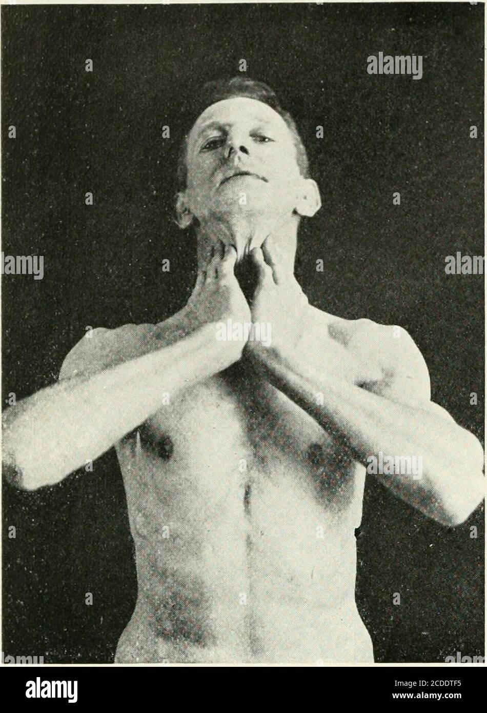 . Massage & Übungen kombiniert: Ein permanenter Körperkulturkurs für Männer, Frauen und Kinder: Gesundheitsfördernde, vitalisierende, prophylaktische, verschönernde: Ein neues System der charakteristischen Grundlagen der gymnastischen und indischen Yogis-Konzentrationsübungen kombiniert mit wissenschaftlichen Massagebewegungen: Mit 86 Abbildungen und tiefen Atemübungen. Abb. 1 C. Abb. 1 D.. Abb. 1 E. tun diese Übung fünf Mal dauert etwa eine halbe Minute. Anmerkung I. während die Finger auf der Seite der Halswirbel den Hals streicheln, sollten die Ellbogen so hoch wie möglich angehoben werden. Hinweis II. Einatmen wh Stockfoto