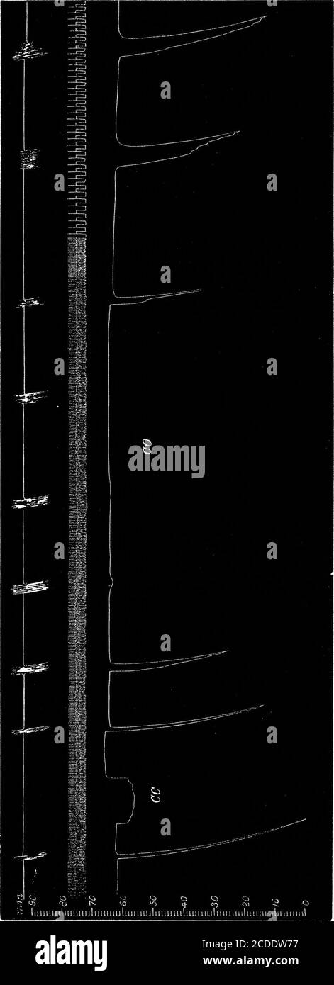 . Auf zerebrale Anämie und die Auswirkungen, die Ligation der zerebralen Arterien folgen . ; es ergibt sich ein fit, dann Extensorspasmus und Atemlähmung. Der Kortex ist während des Extensorkrampfes erregbar.bei der Stimulation des Armbereichs wird die Ausdehnung erhöht. Die Erregbarkeit verschwindet innerhalb von 1 Minute nach dem Ausfall der Atmung. Anmerkung. - der Affe hatte Durchfall; das Zimmer war sehr kalt, und das Gehirn wurde mit warmen Wollkissen nicht geschützt. VI Motorhaube Affe (ca. 4 Jahre alt). Der extensor carpi radialis ist mit einem isometrischen Hebel verbunden und seine Kontraktionen werden aufgezeichnet. Der Armbereich ist Stockfoto