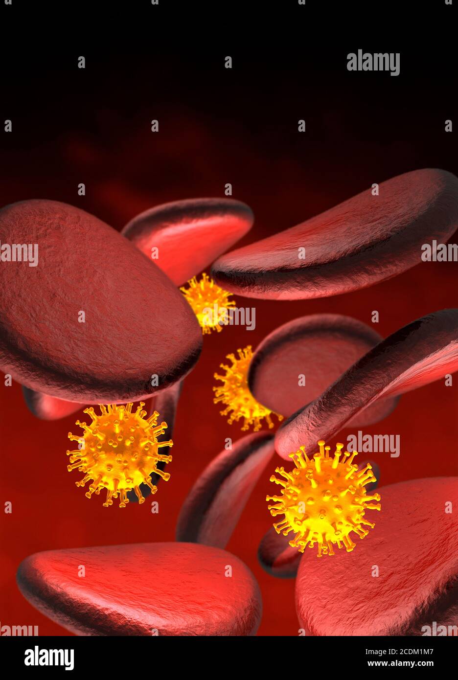 Coronavirus-Infektion, konzeptionelle Illustration. Stockfoto