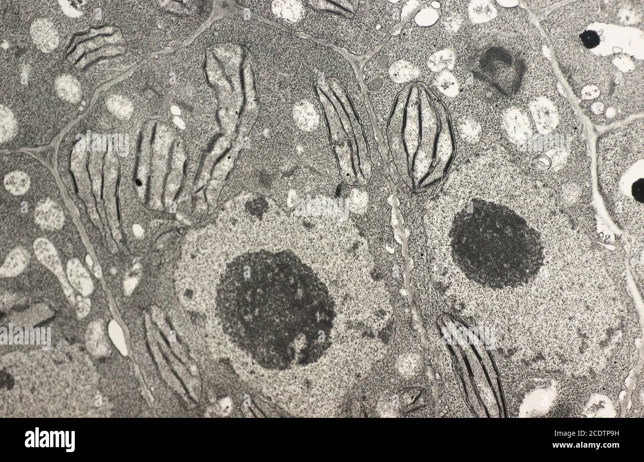 Vegetale Zelle mit Zellkern, Zellwand, Nukleolen, Chloroplast und Stärke. Ein ultradünner Abschnitt von Mesophyll-Zellen mit Chloroplast str Stockfoto