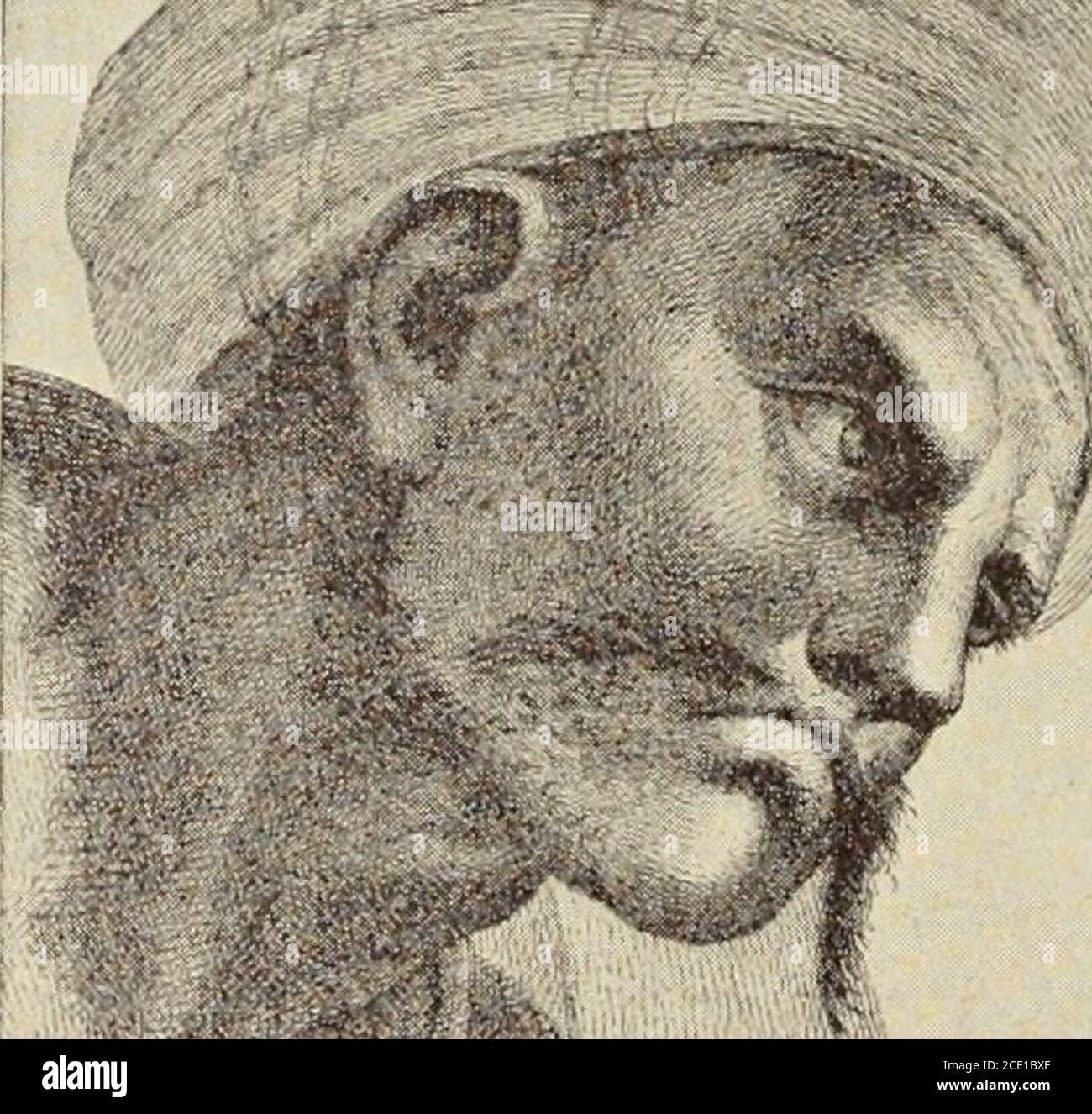 . Ein Inbegriff der Geschichte der Medizin. Von Roswell Park ... Basierend auf einem Kurs von Vorträgen in der Universität von Buffalo. 2d ed. Illustriert mit Porträts und anderen Stichen. O widmet sich ihm muss in der Wissenschaft der Anatomie versiert werden, von wliich Galenhat uns das Wissen übermittelt. . In fein, niemand sollte sich erlauben, tliis schwierige Kunst zu versuchen, ohne ein perfektes Wissen über Anatomie und raction von reniedi(!s. Über Dissc-ctions wird kein Wort gesagt. Iiowtner, von dem wir schließen, dass sie nicht in IDs Zeit toleriert wurden.Er griff begeistert an die cau Stockfoto